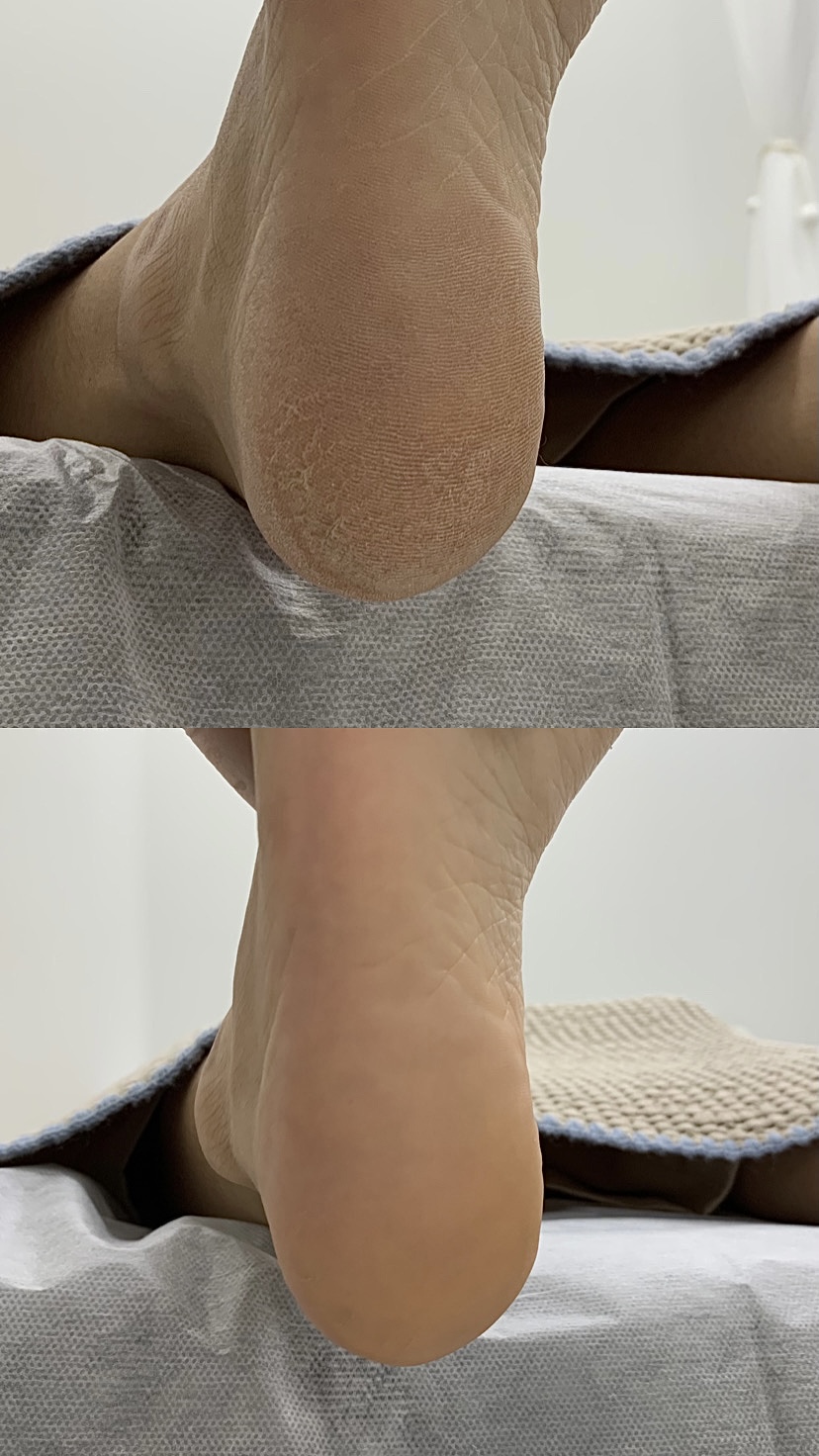 포레스틱 대표 이미지