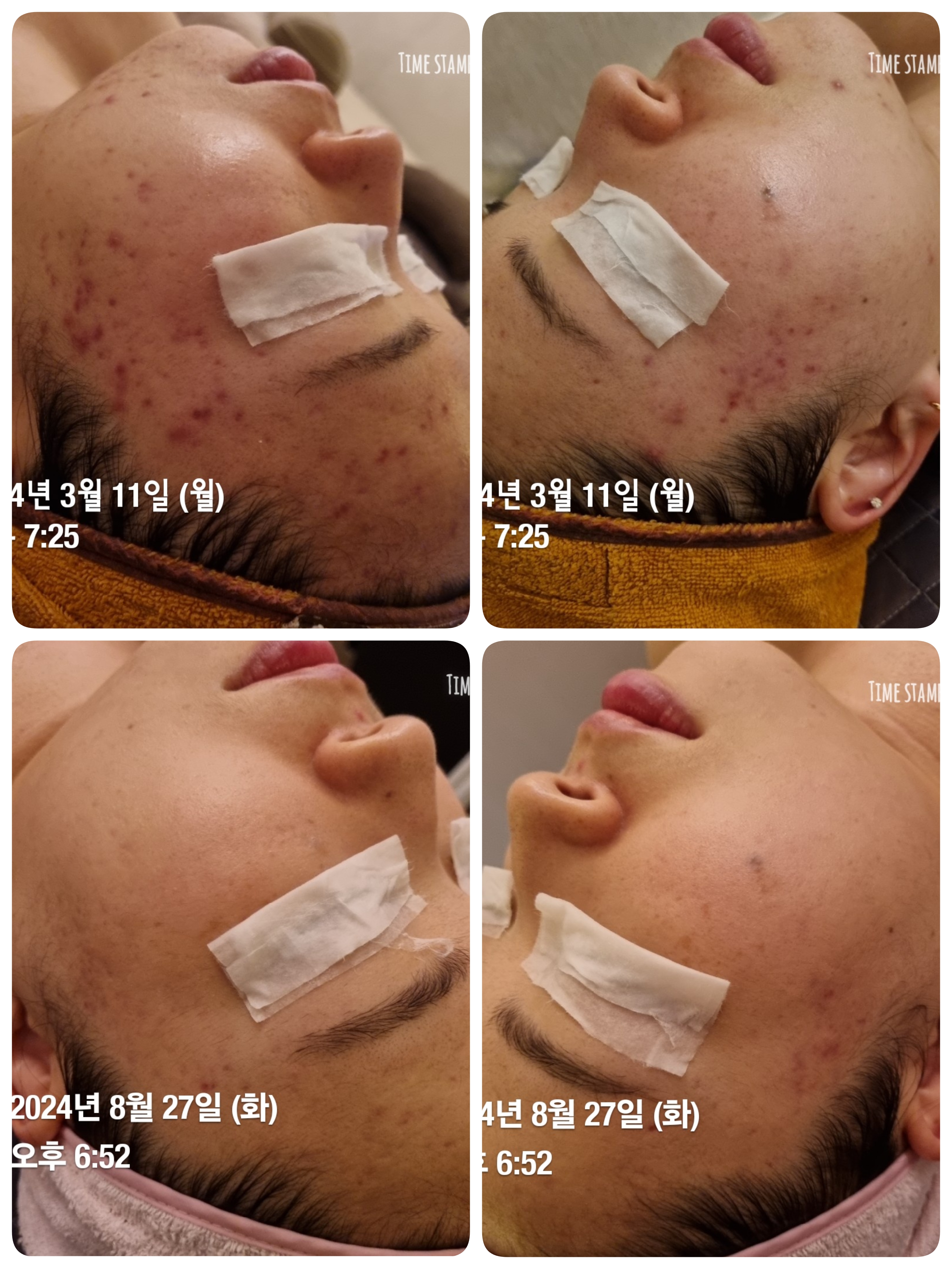 티나에스테틱 대표 이미지