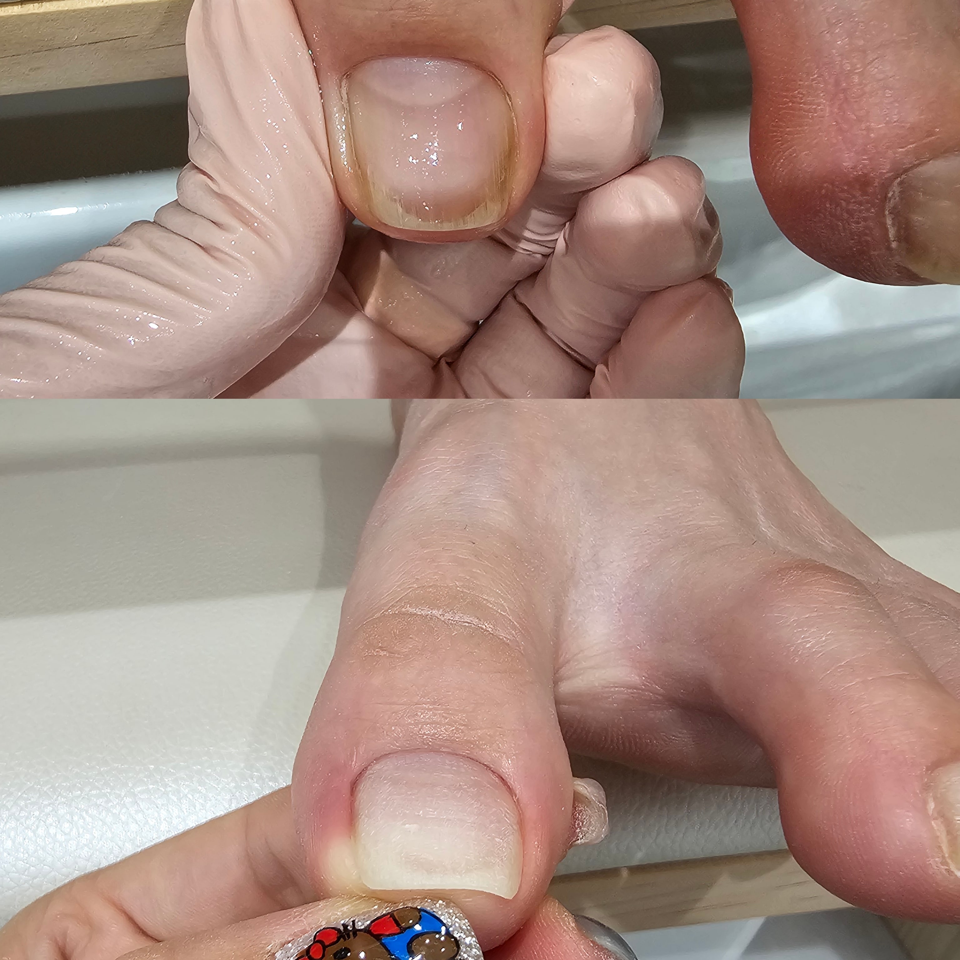 Nail, 수