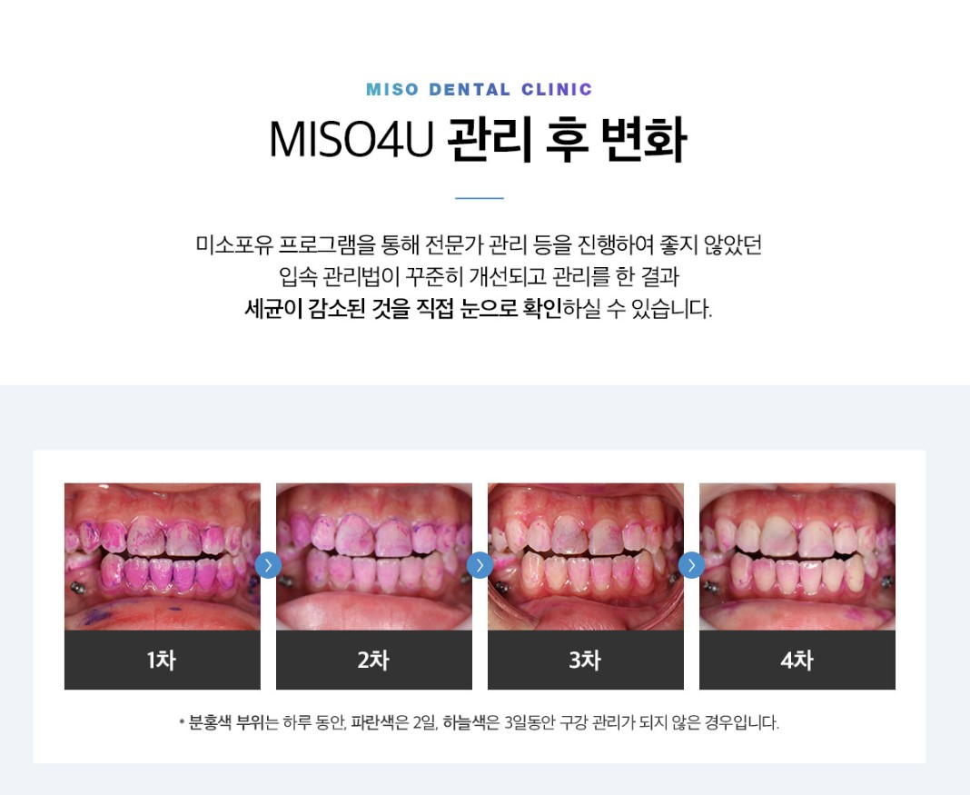 연세고운미소치과의원 대표 이미지