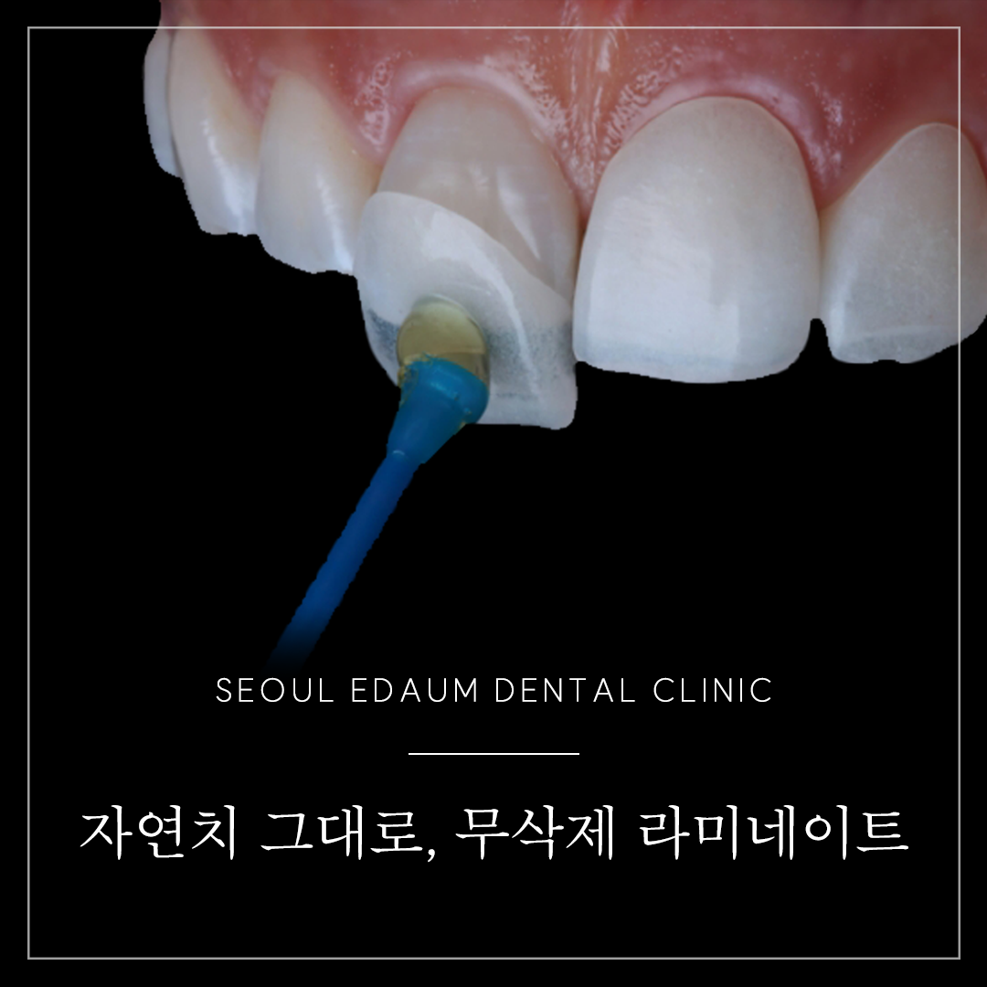 서울이다움치과의원 대표 메뉴
