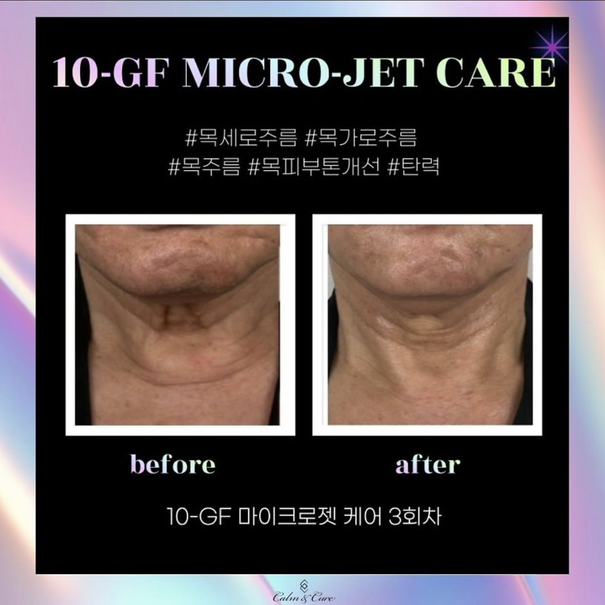 시흥능곡뷰티케이 photo 10