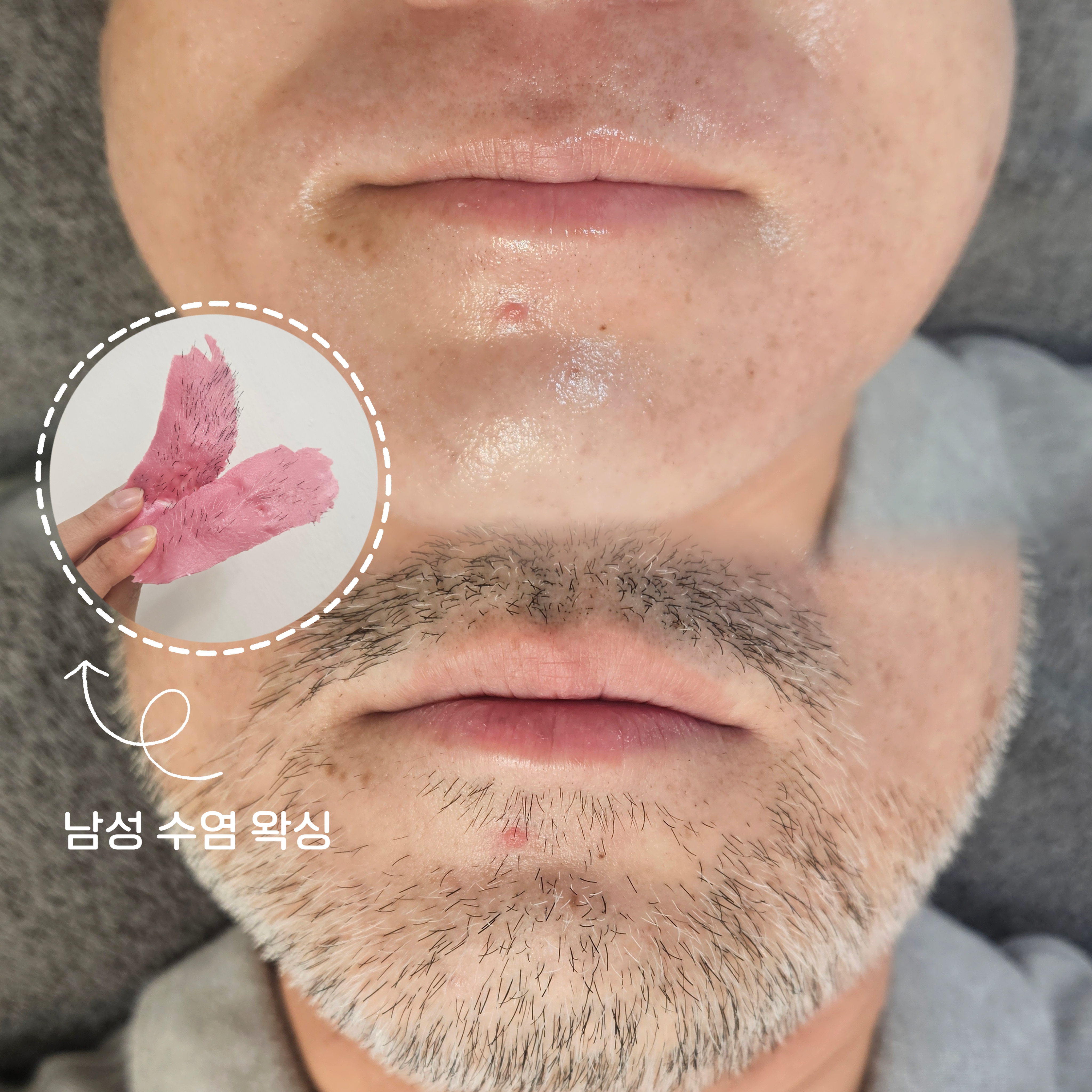 단미