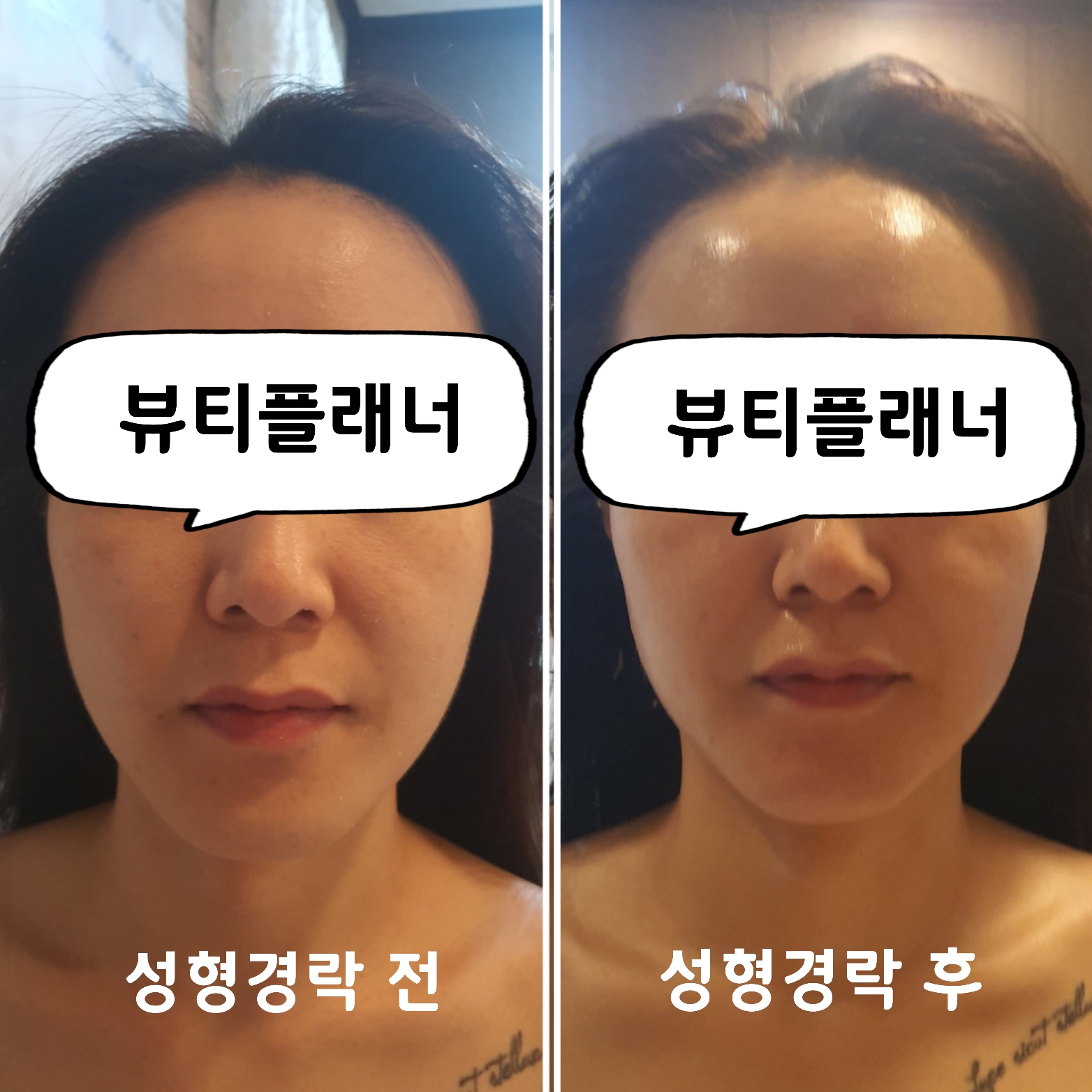 뷰티플래너 용호점 얼굴경락 photo 5