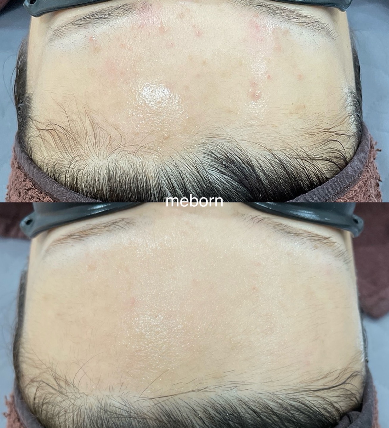 미본에스테틱 대표 이미지