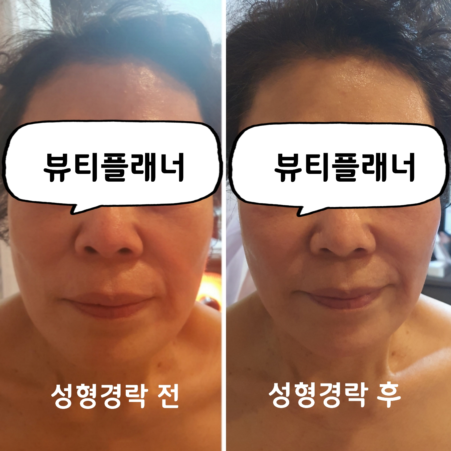 뷰티플래너 용호점 얼굴경락 대표 이미지