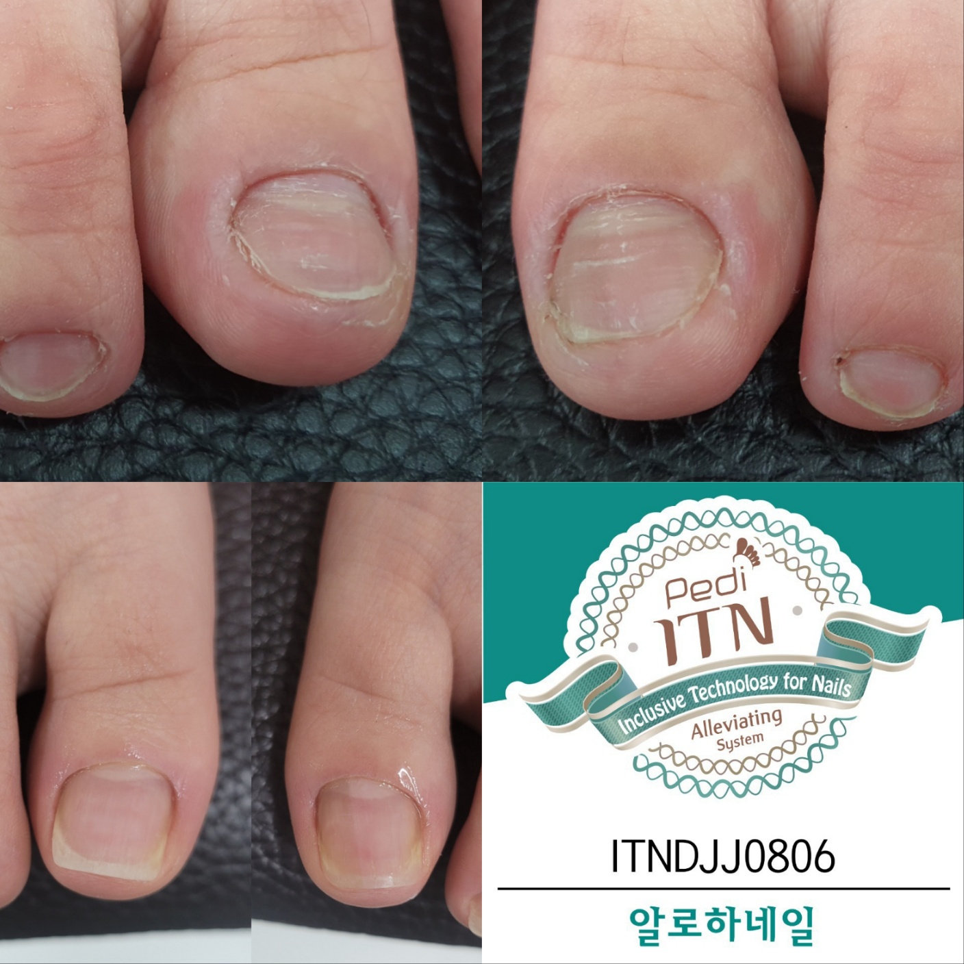 알로하네일 대표 이미지