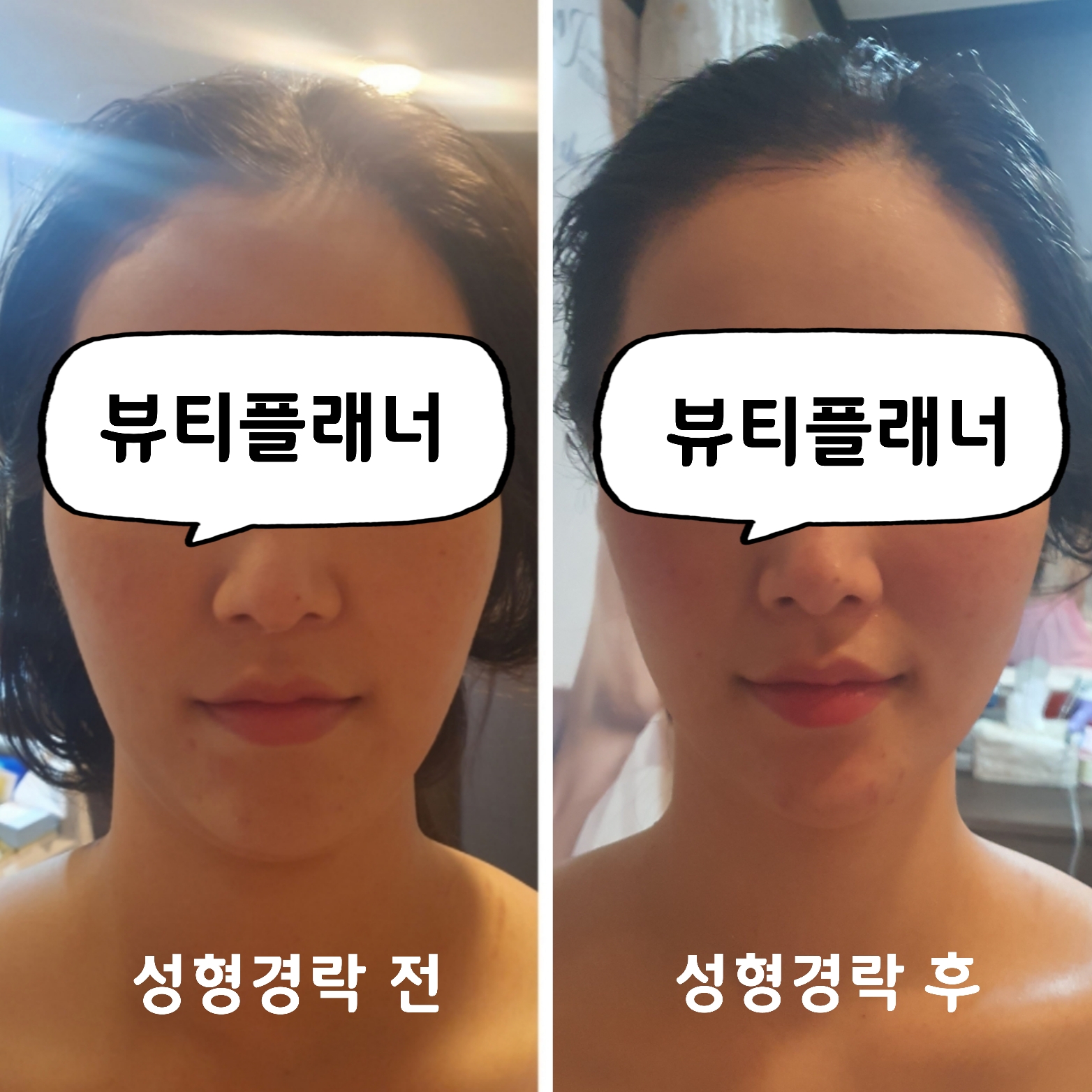 뷰티플래너 용호점 얼굴경락 photo 10