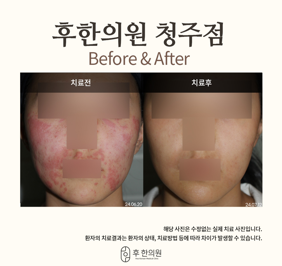 후한의원 청주점 대표 이미지