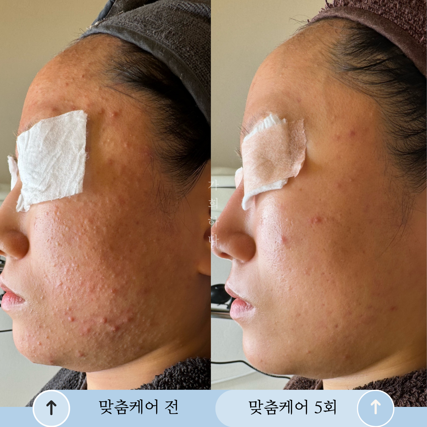 가희하다 잠실 대표 이미지