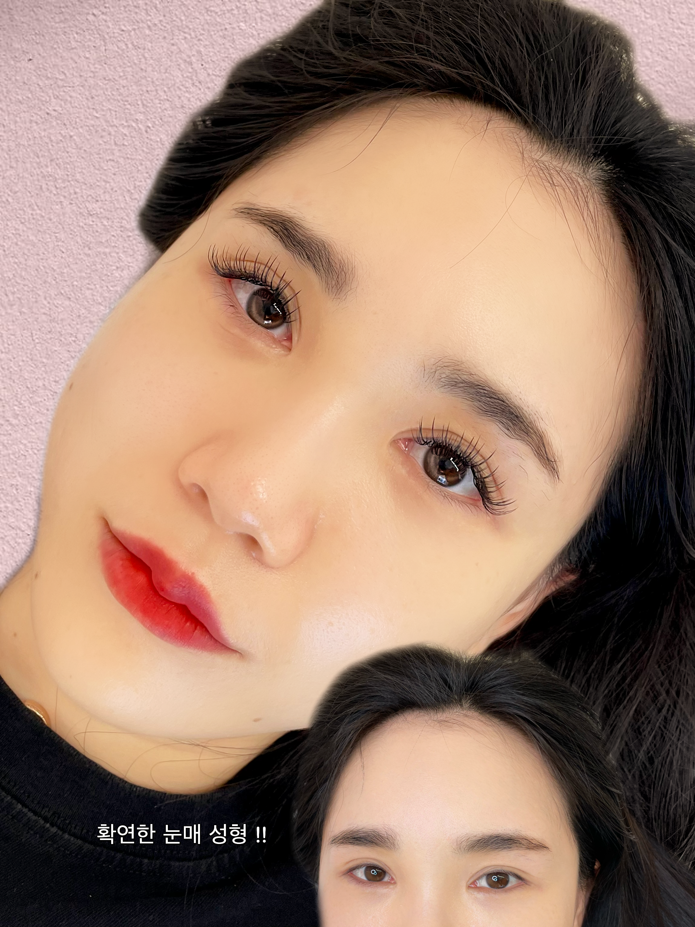 어니미즈