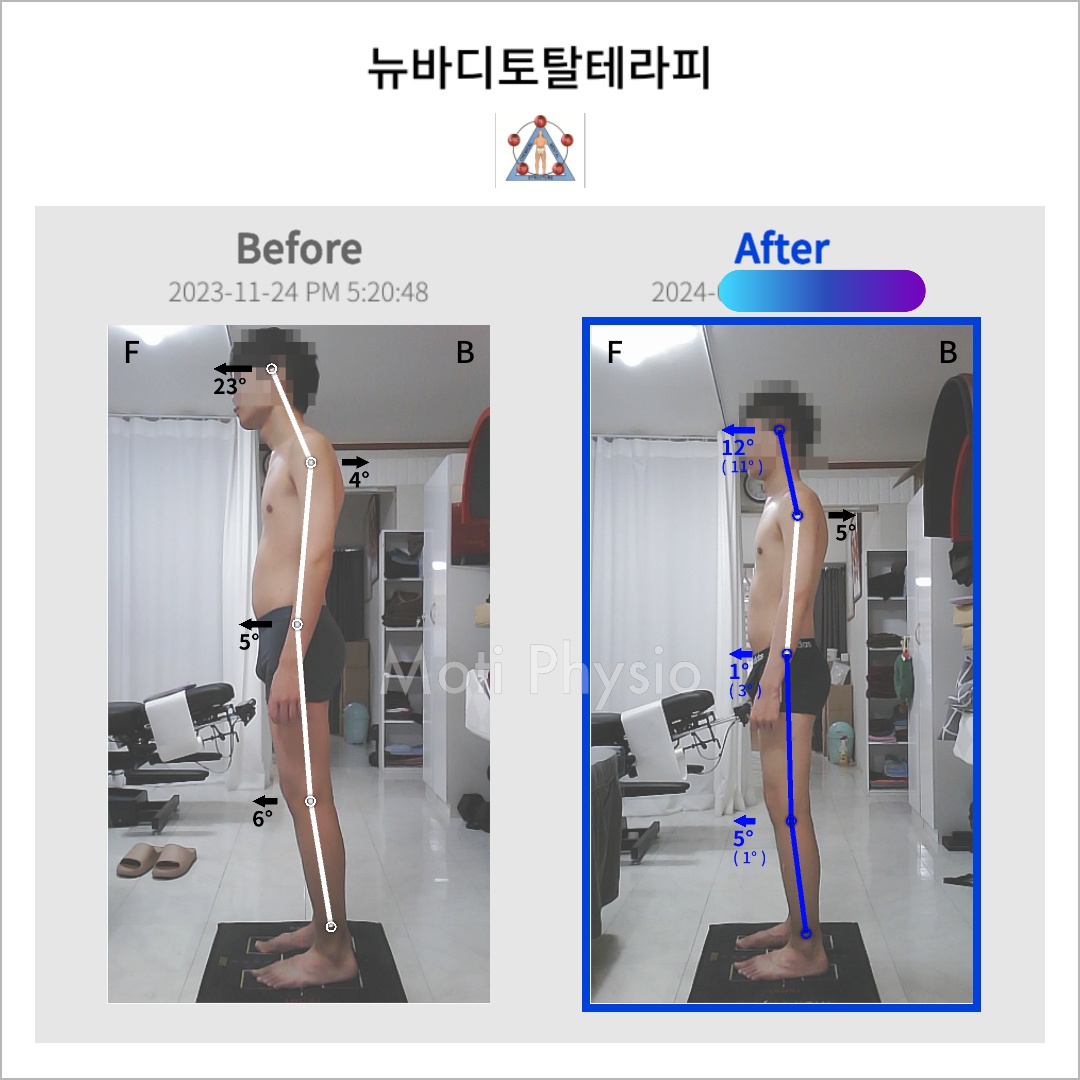 뉴바디토탈테라피 통증 체형교정센터