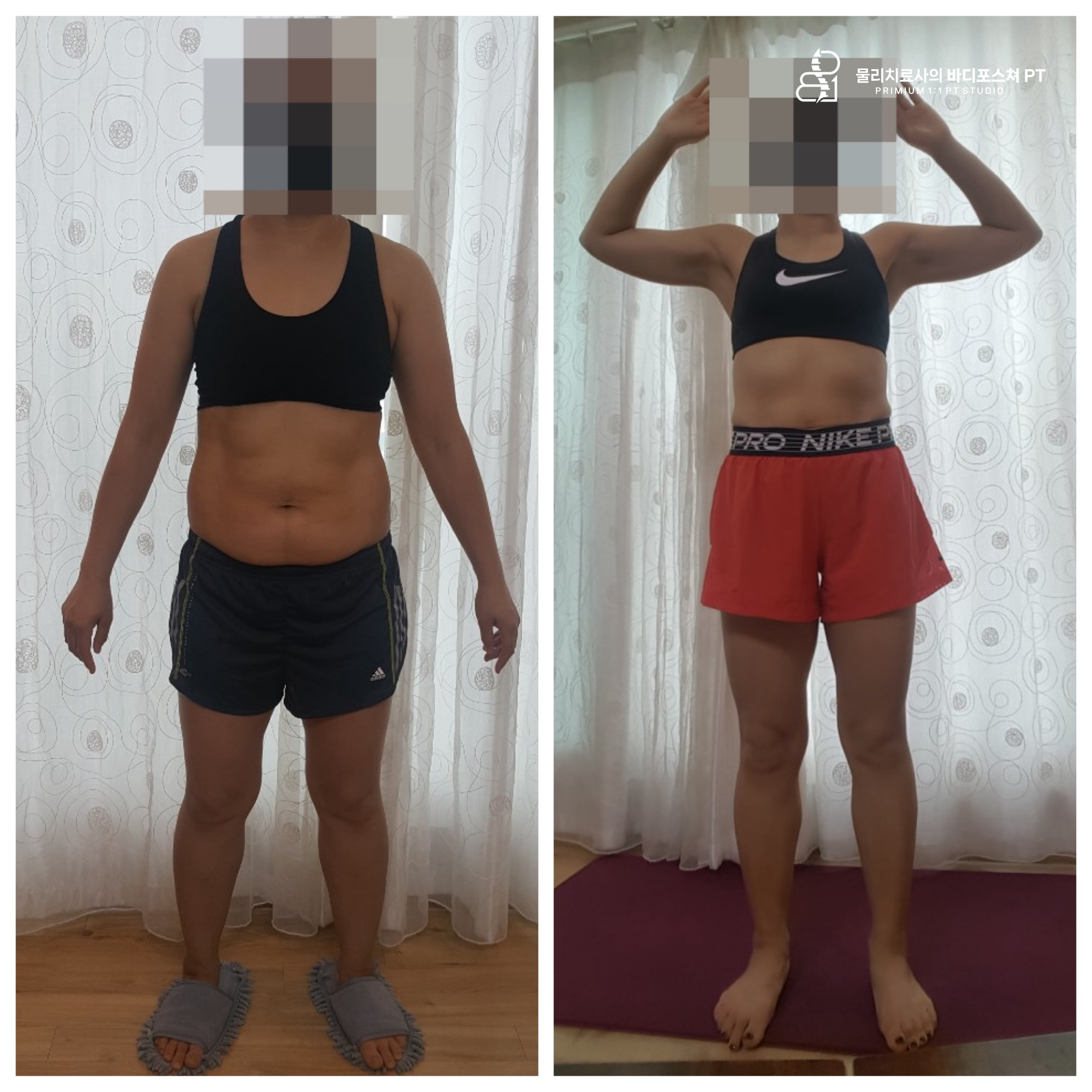 물리치료사의바디포스쳐PT