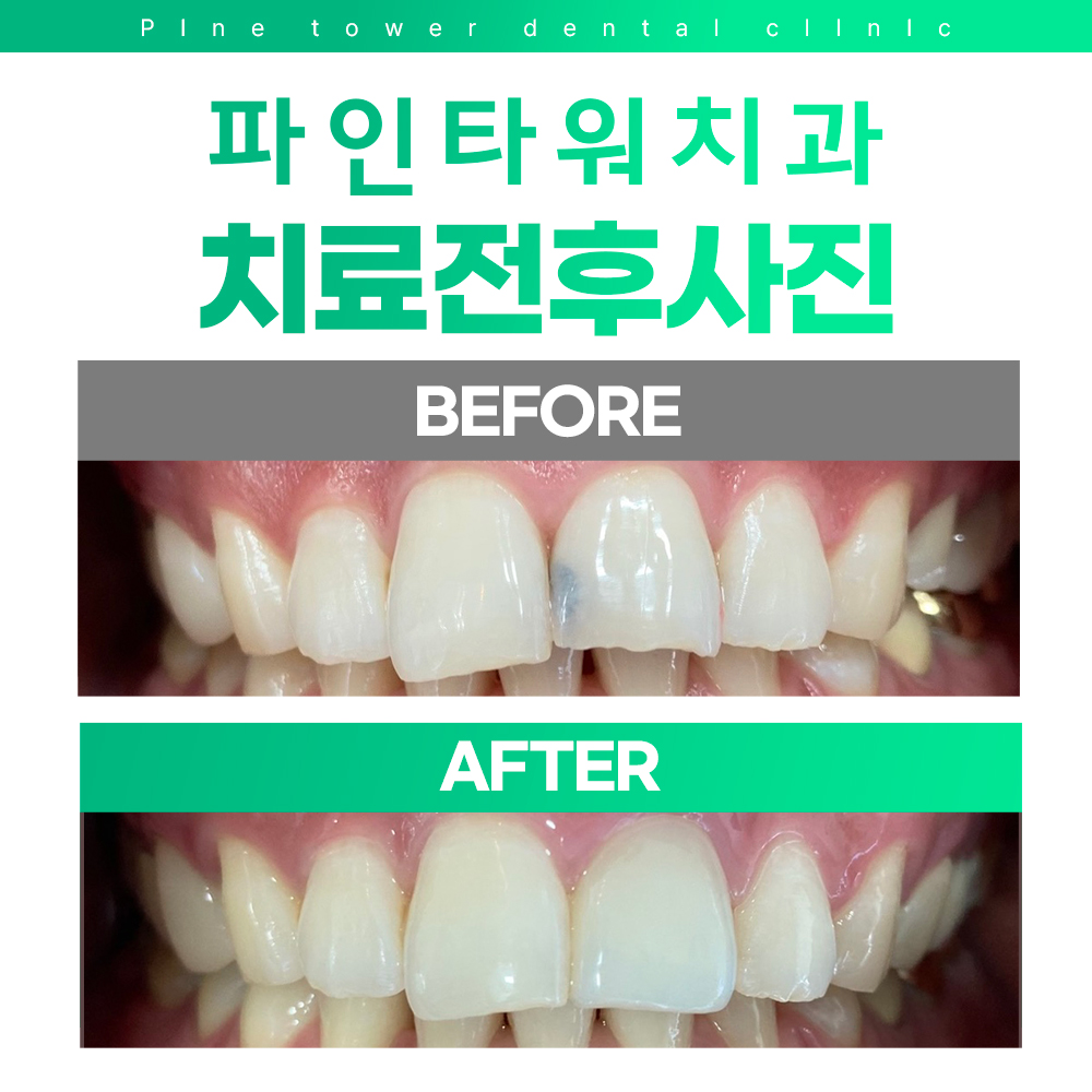 파인타워치과의원