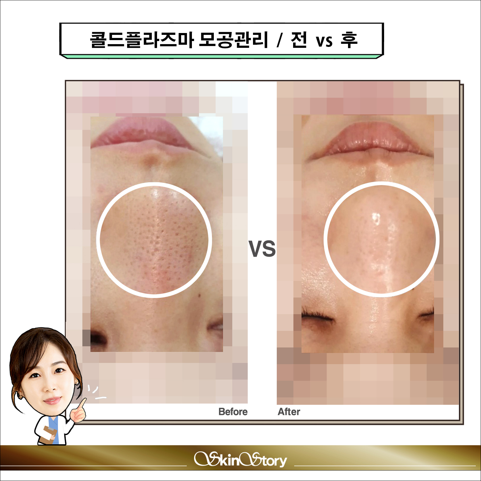 스킨스토리