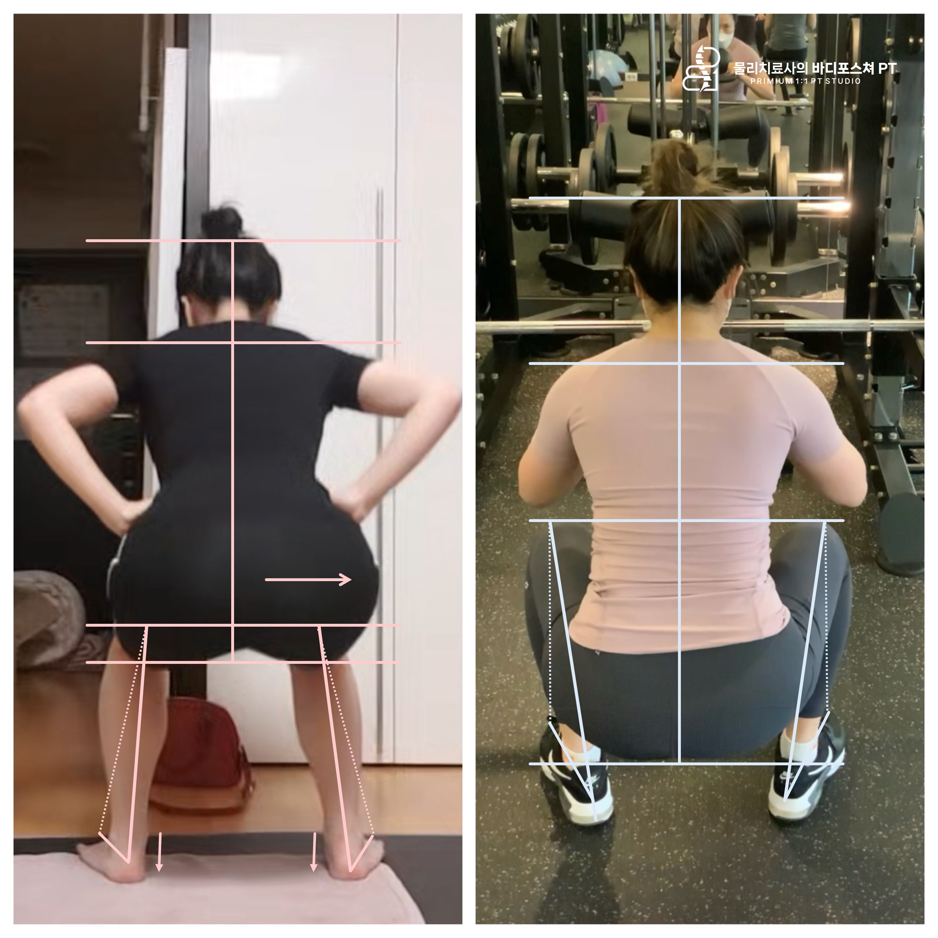 물리치료사의바디포스쳐PT