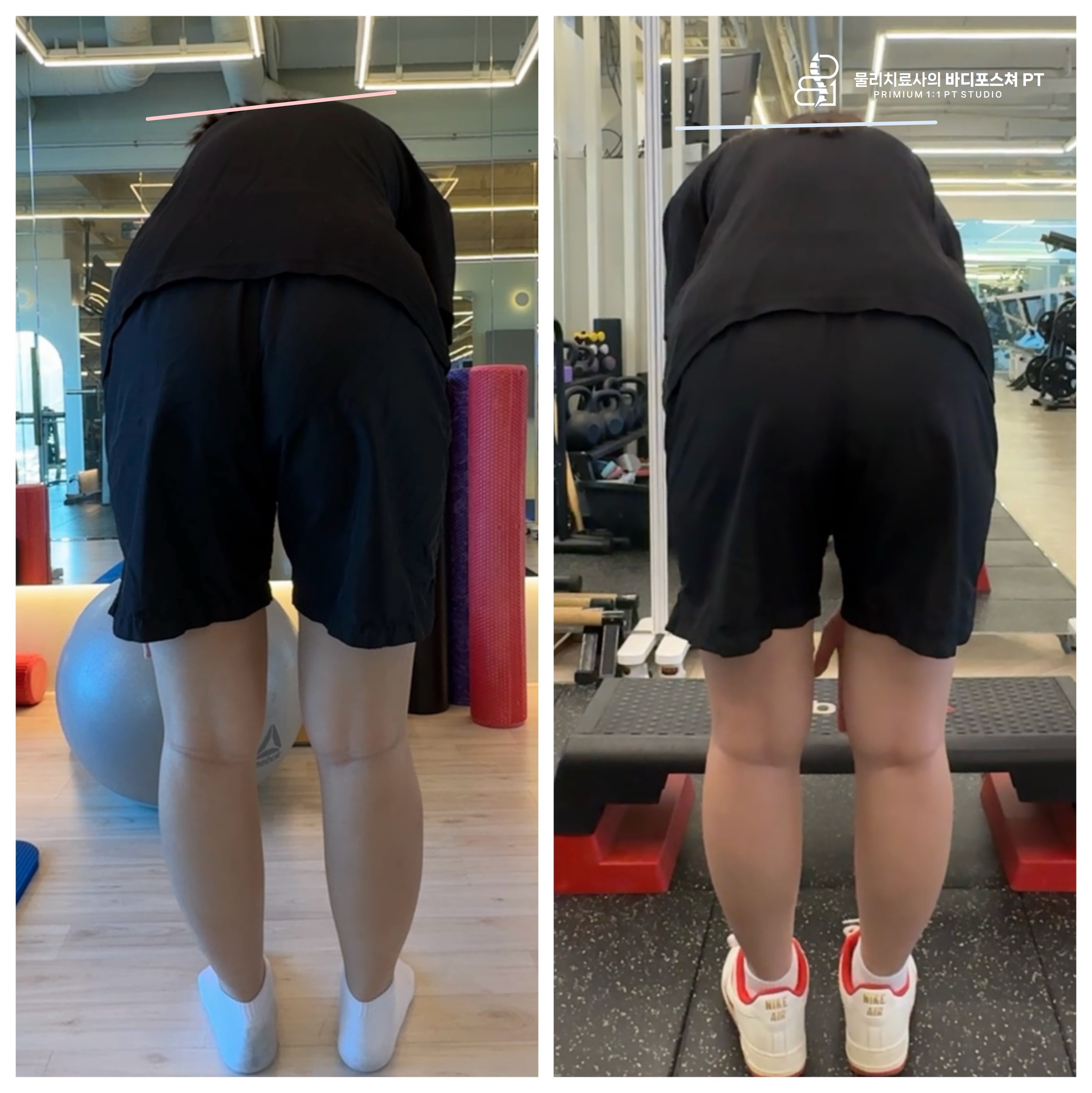 물리치료사의바디포스쳐PT