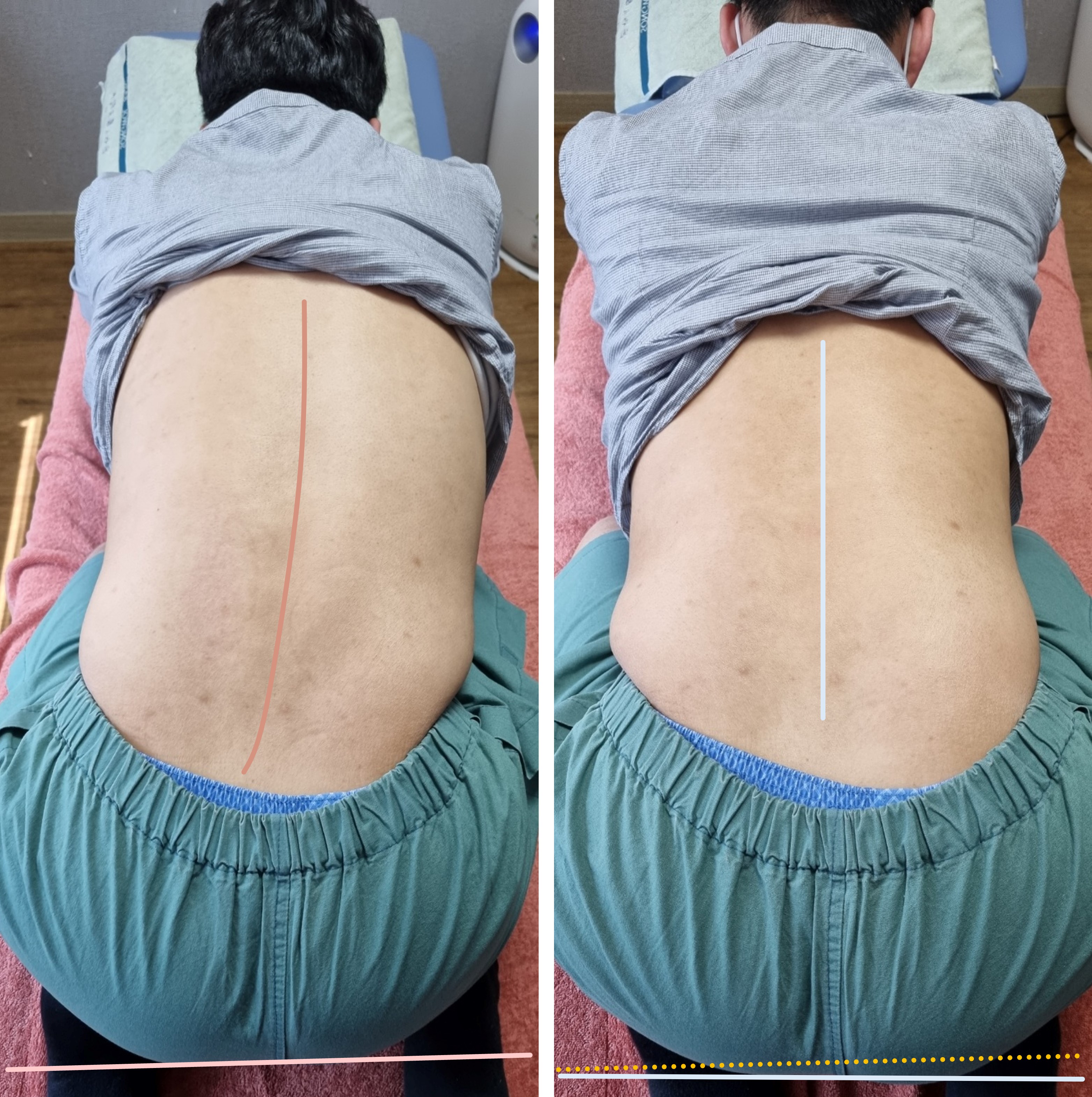 물리치료사의바디포스쳐PT