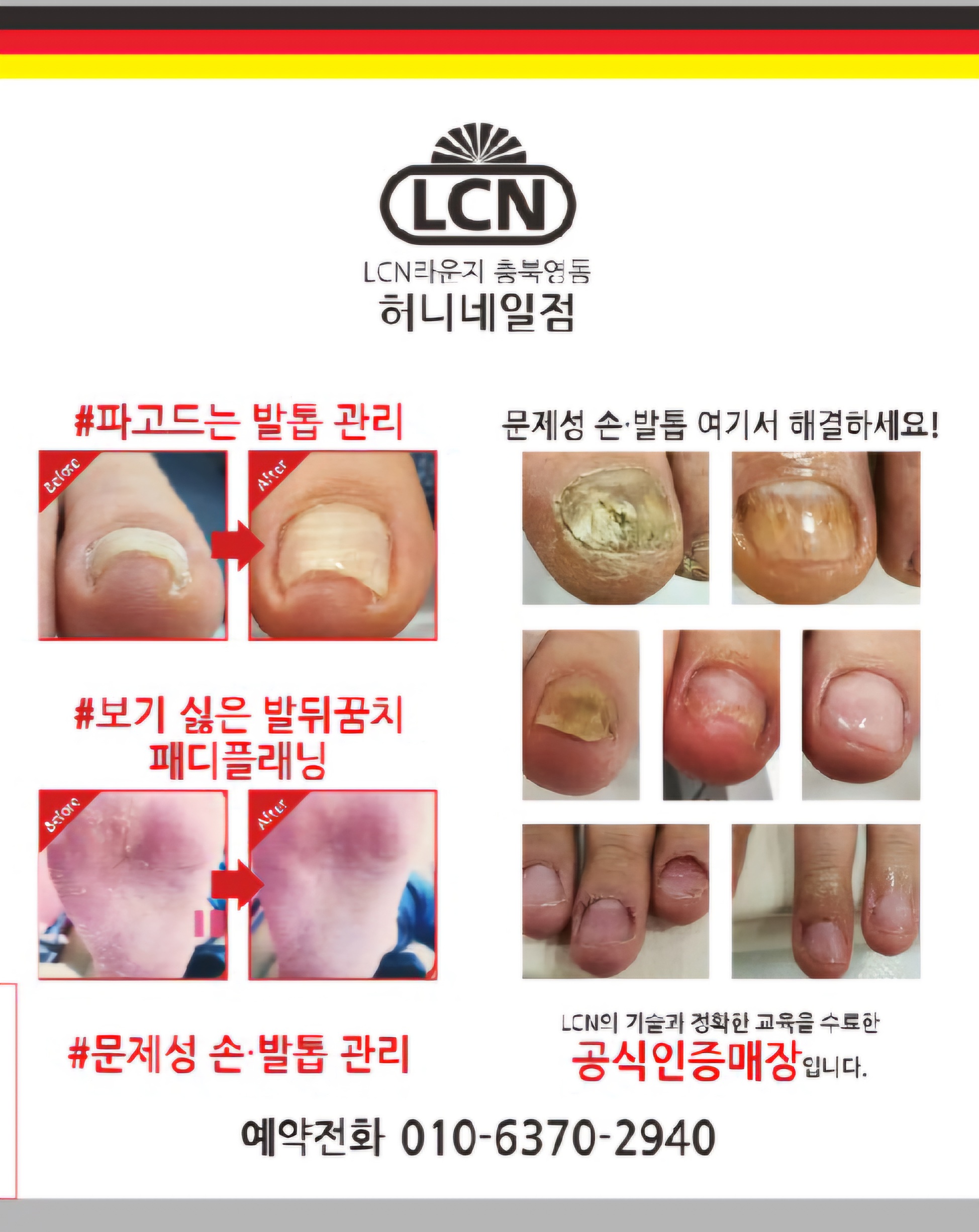 LCN라운지 충북영동점 허니네일
