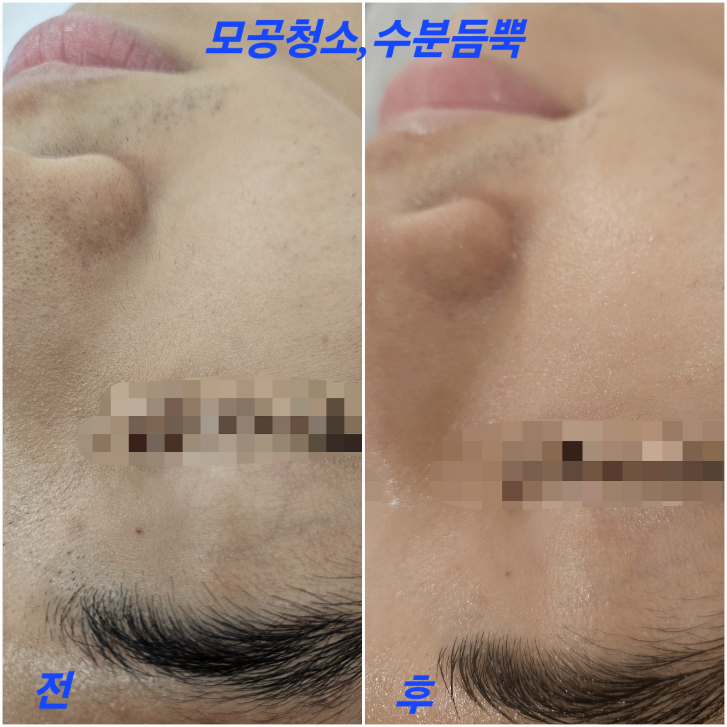 레나뷰티 대표 이미지