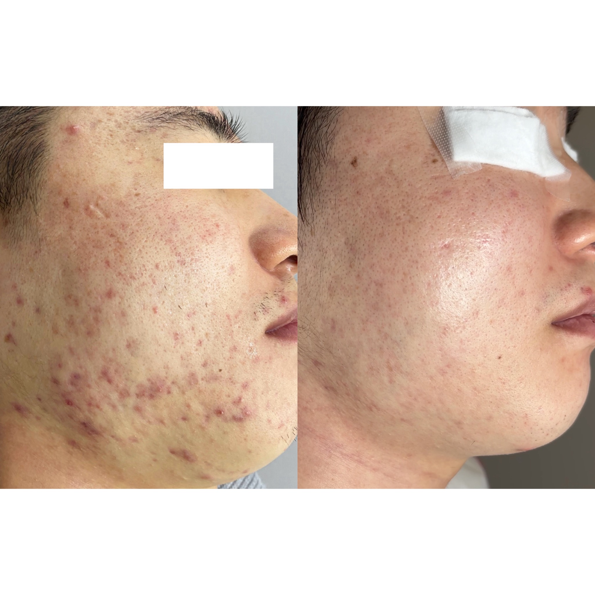 제로스킨 홍대 대표 이미지