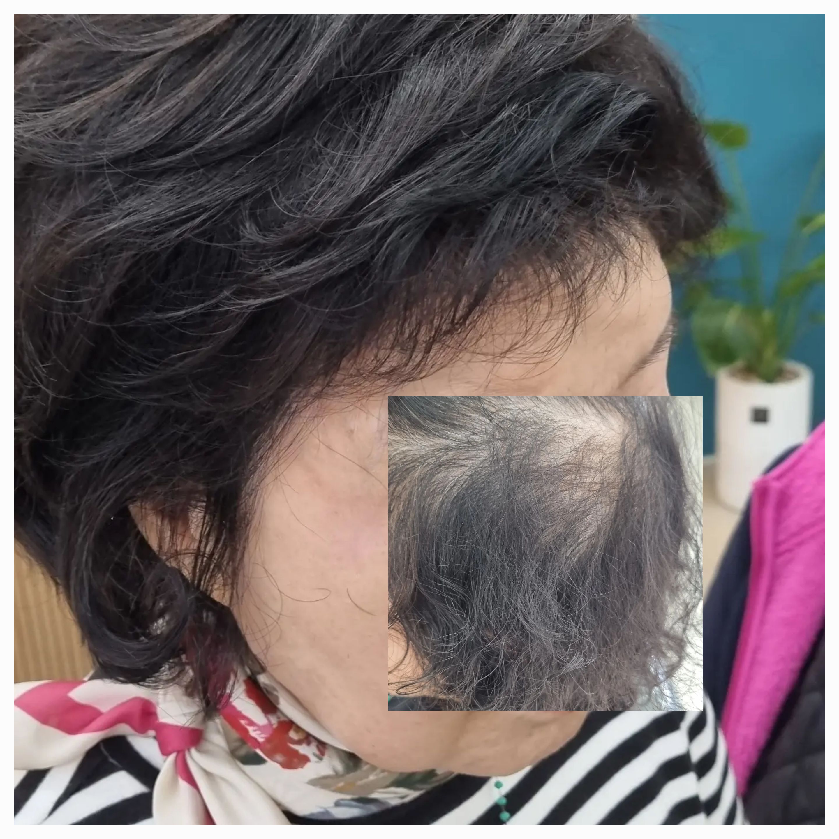 김호증모가발 라피네
