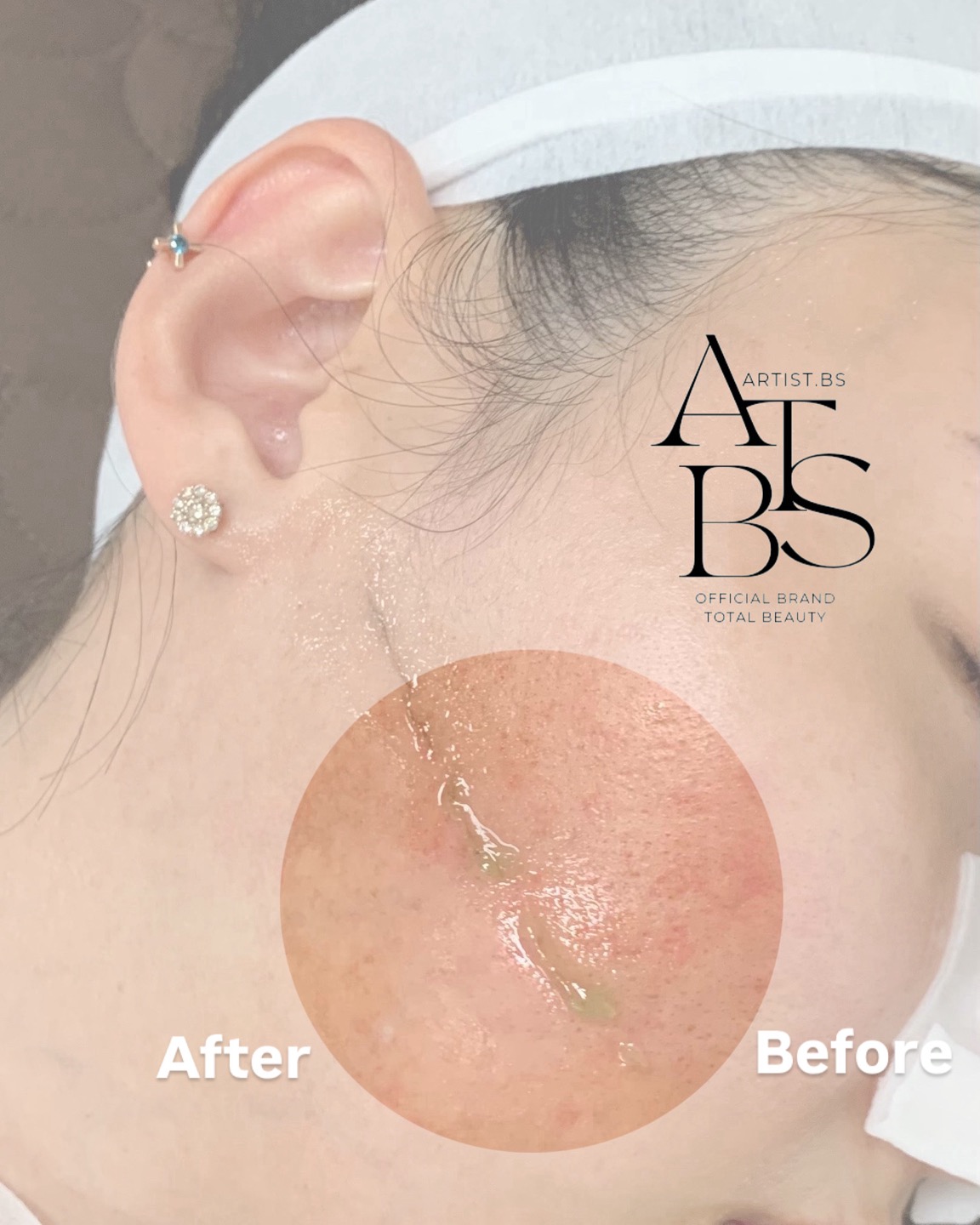 아티스트비에스 의정부점 대표 이미지