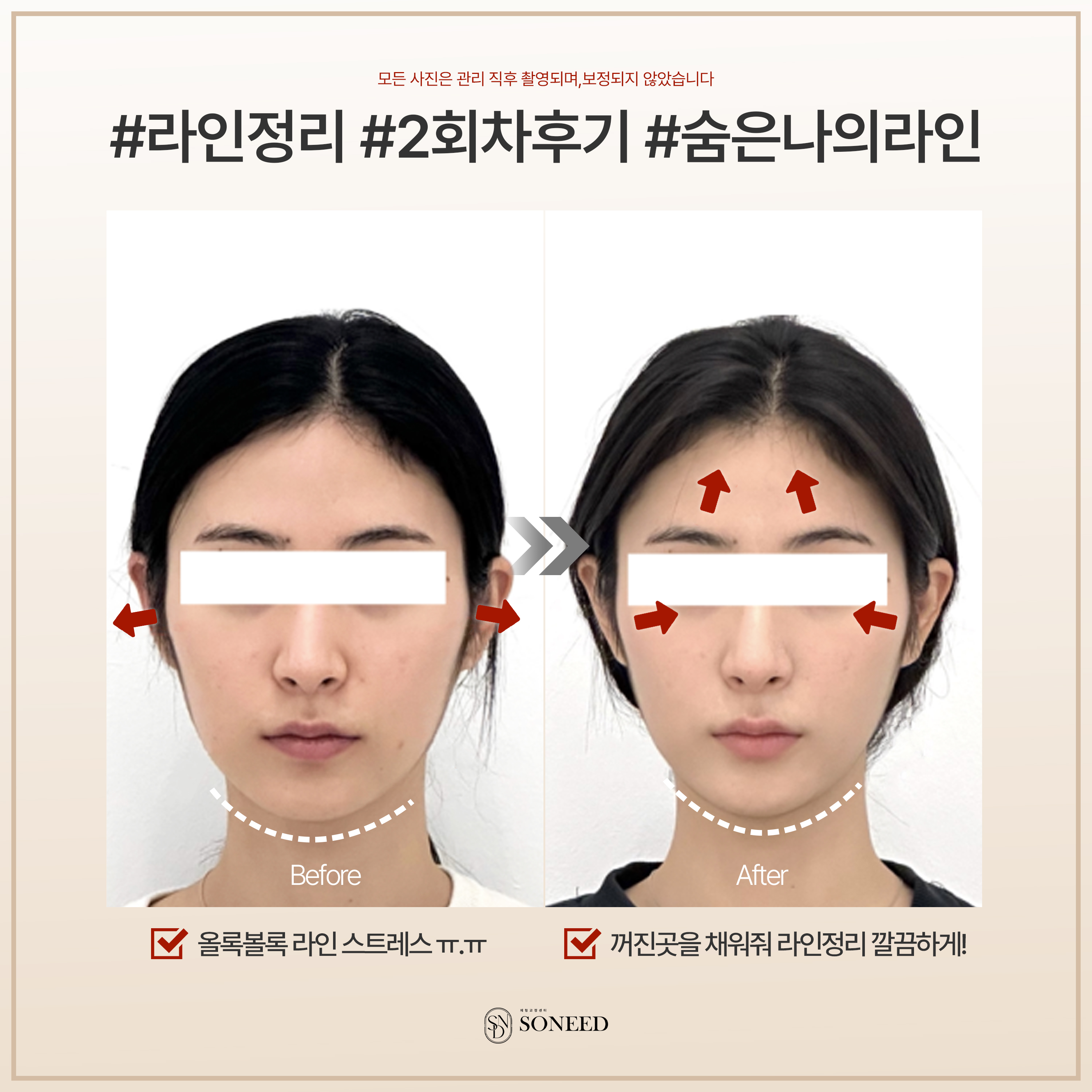 소니드 얼굴윤곽 대표 이미지