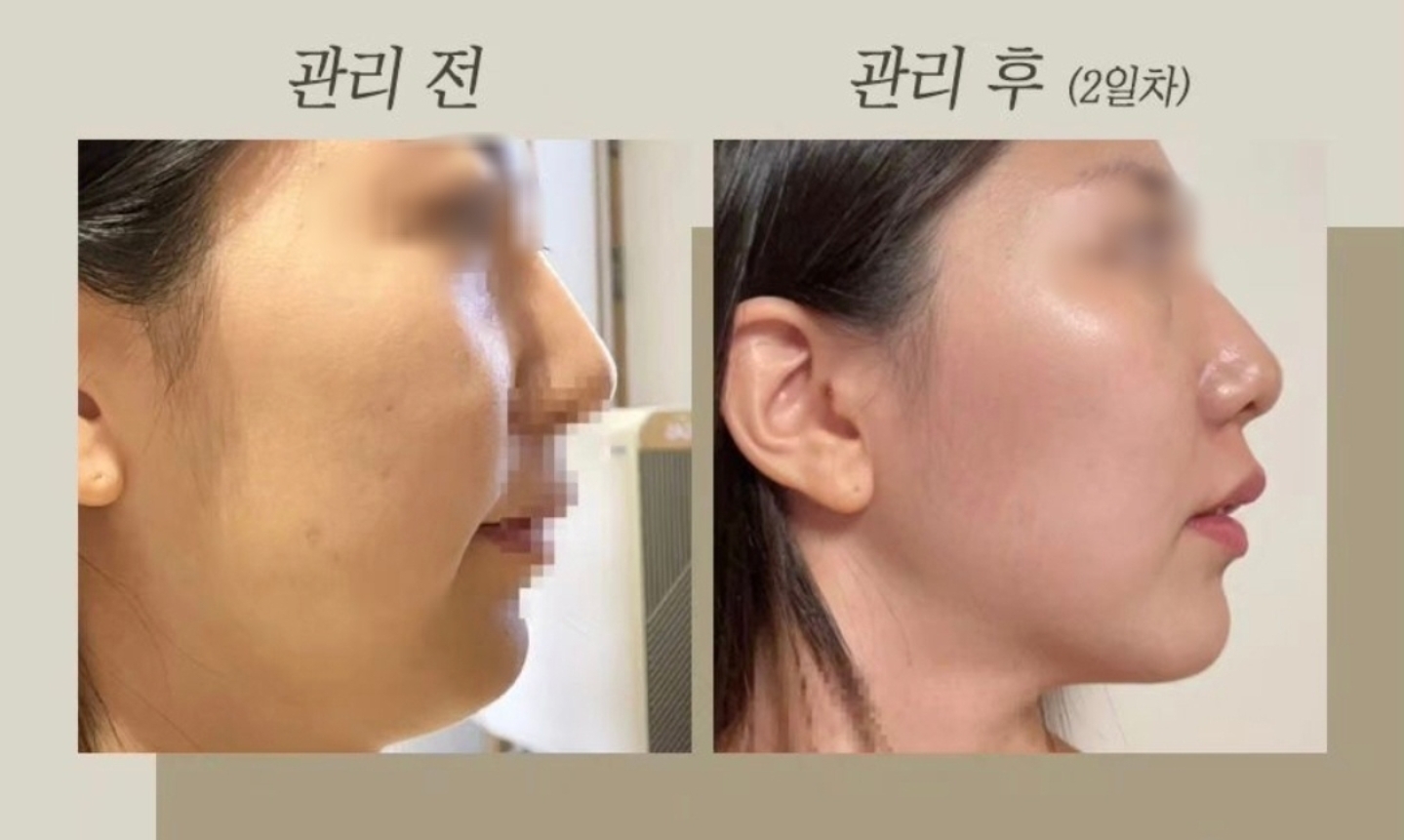 스와니예 대표 이미지