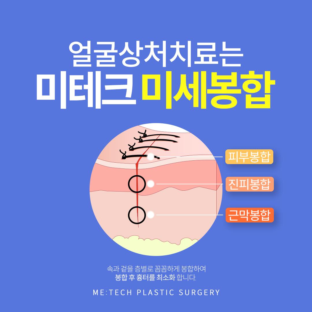 미테크성형외과의원