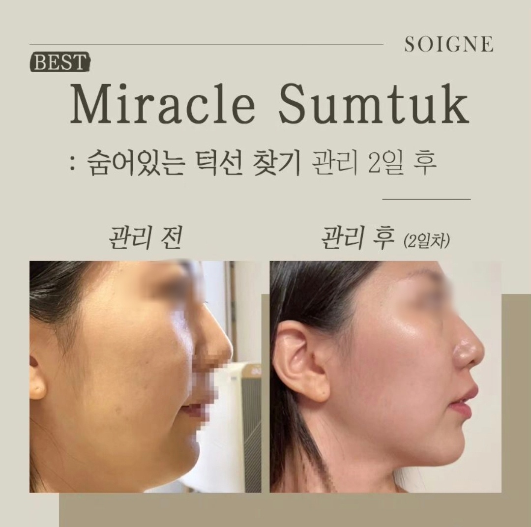 스와니예 대표 이미지