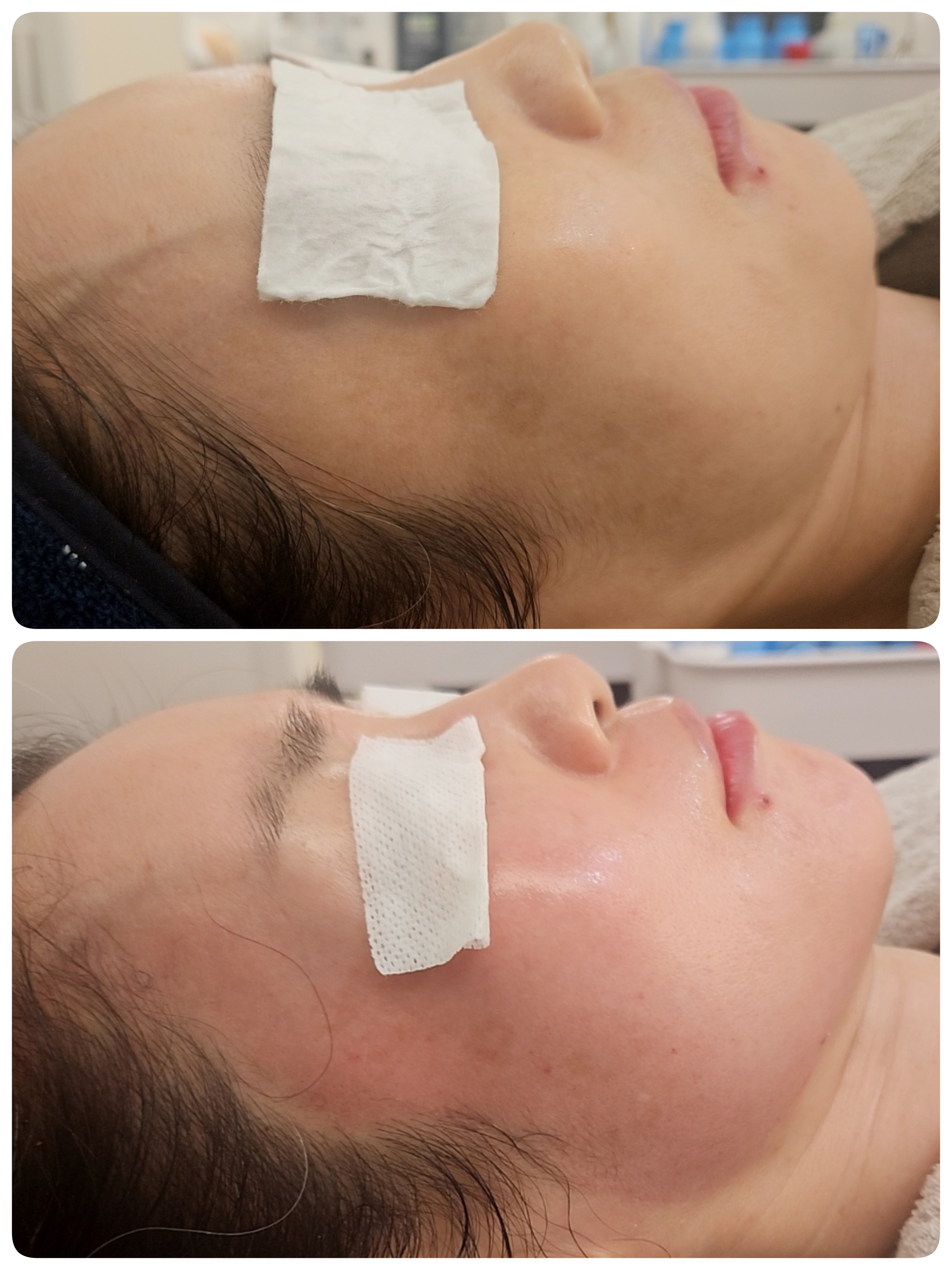 본앤스킨 대표 이미지