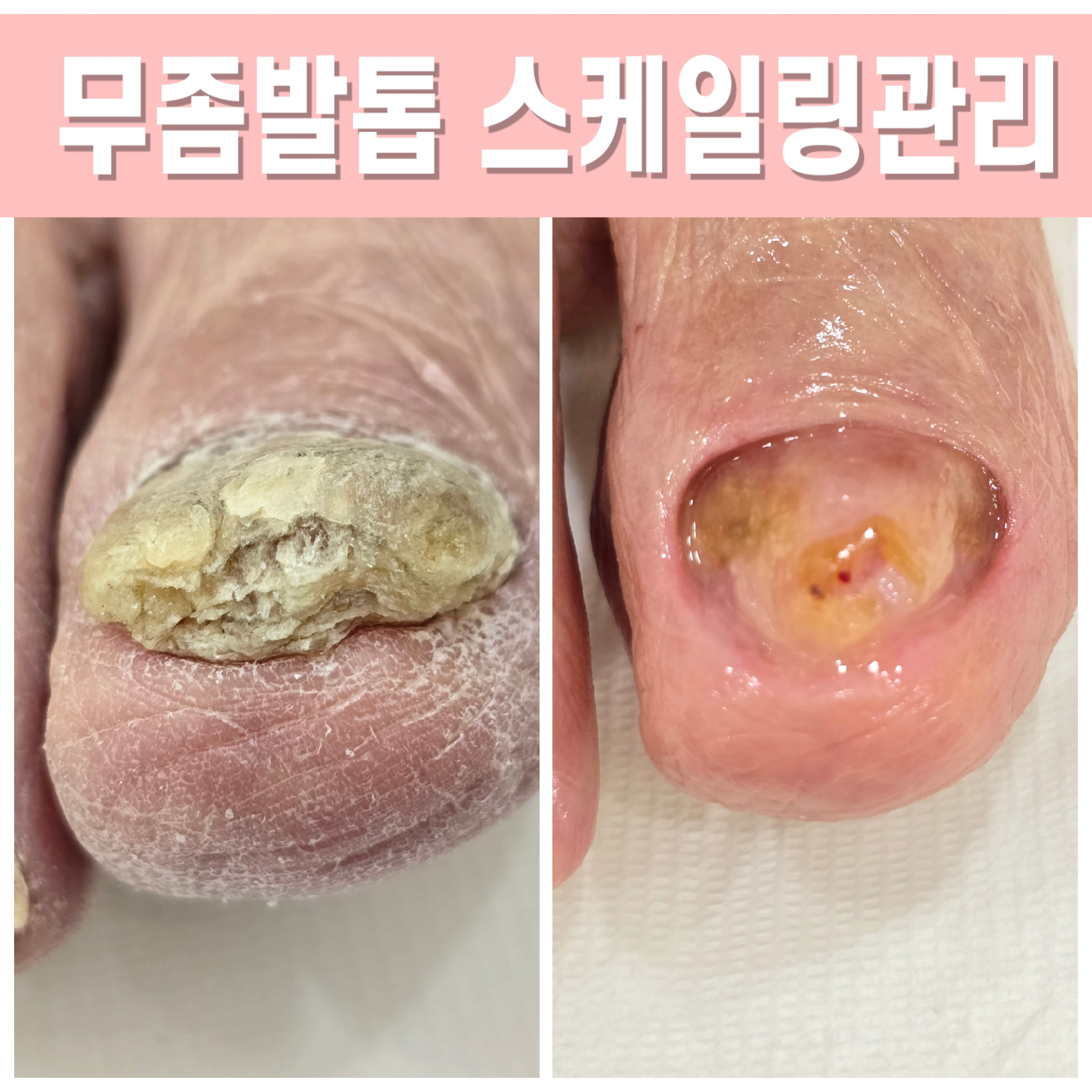 하이푸스 주주네일 내부 또는 관련 모습