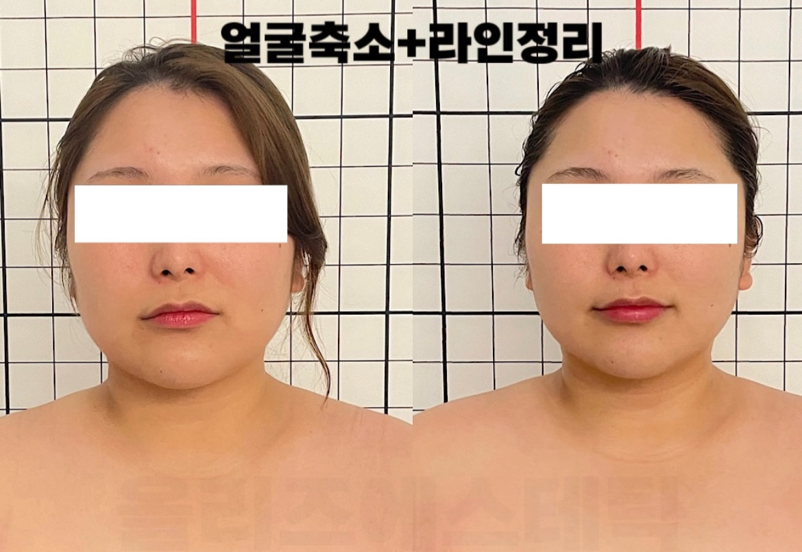 올리즈에스테틱 대표 이미지