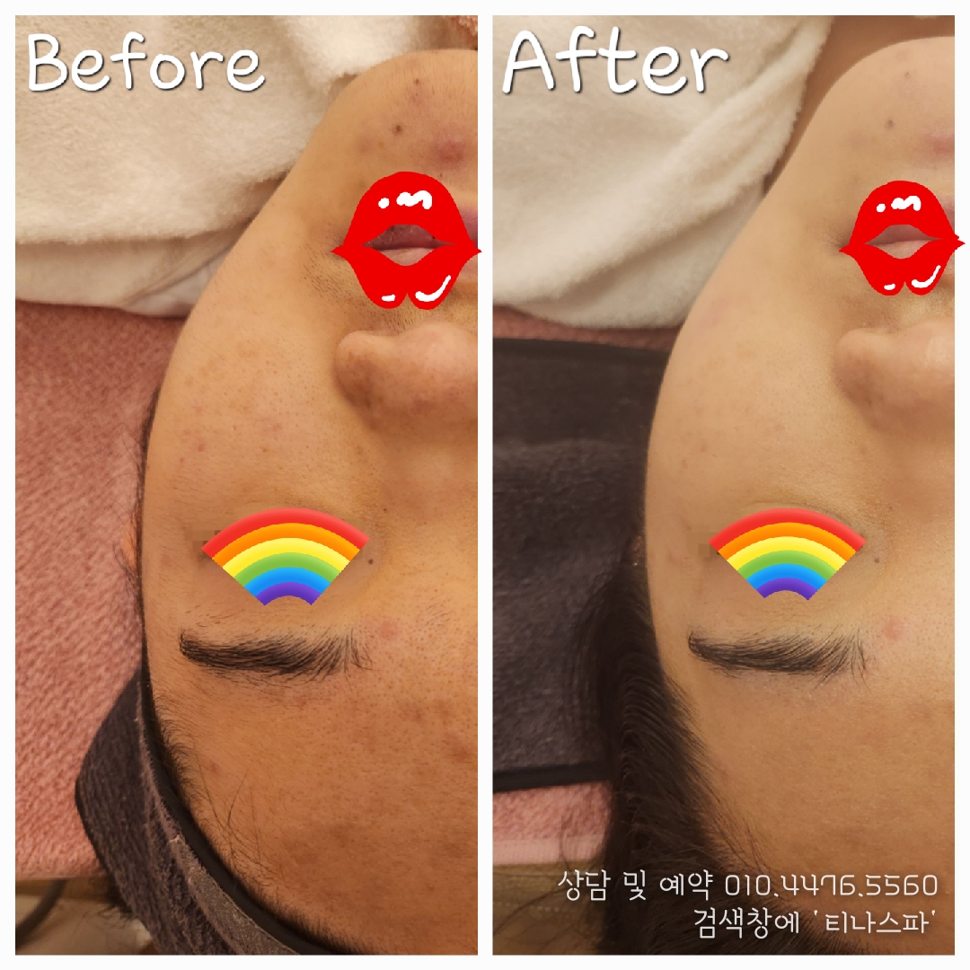 티나스파 photo 6