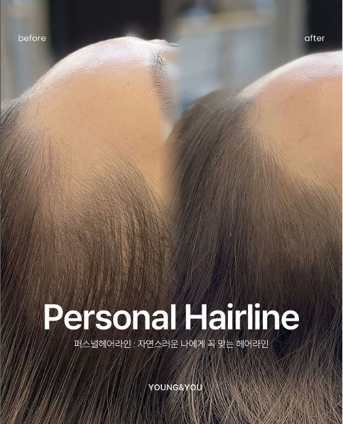 헤일리브 대표 이미지