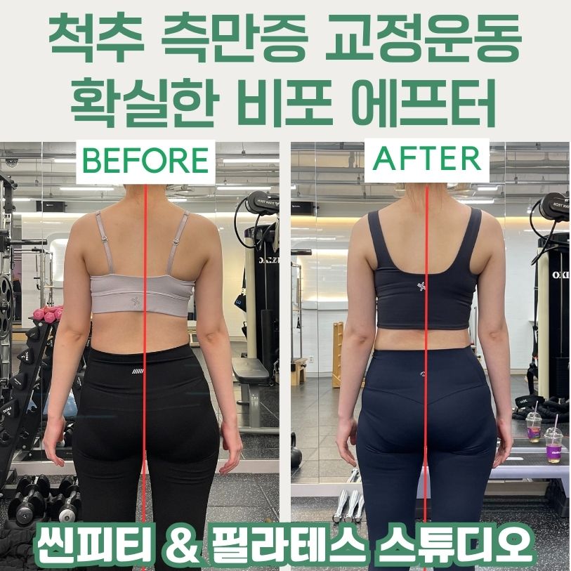 씬피티&필라테스 체형교정PT 구월점 대표 이미지