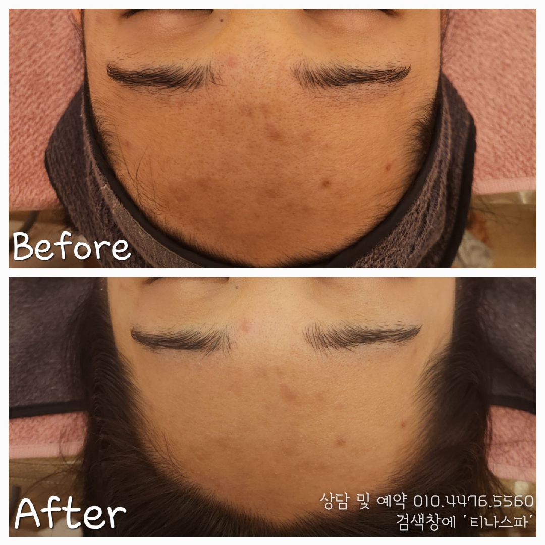 티나스파 photo 5