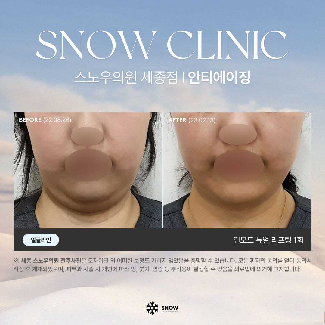 스노우의원 세종점 대표 이미지