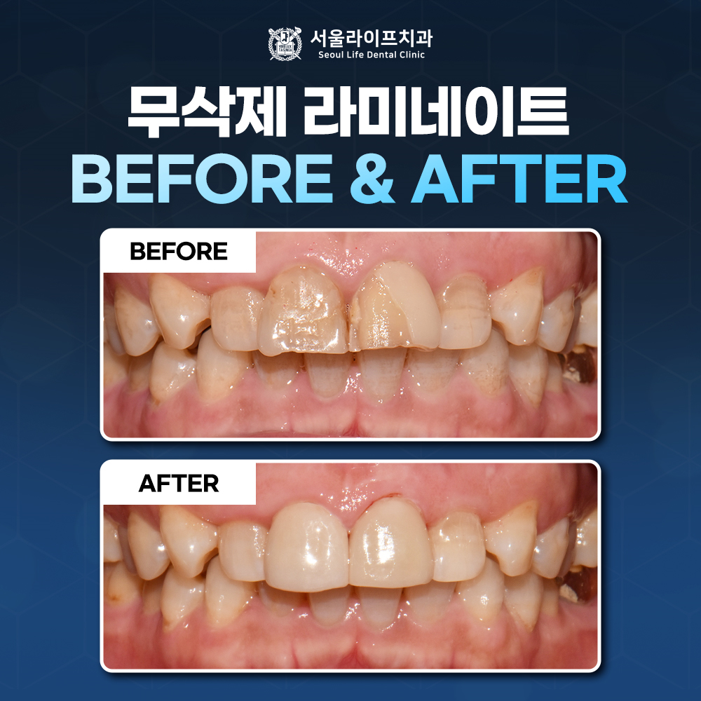 서울라이프치과의원 대표 이미지