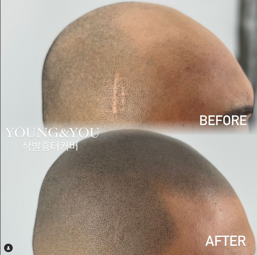 헤일리브 대표 이미지