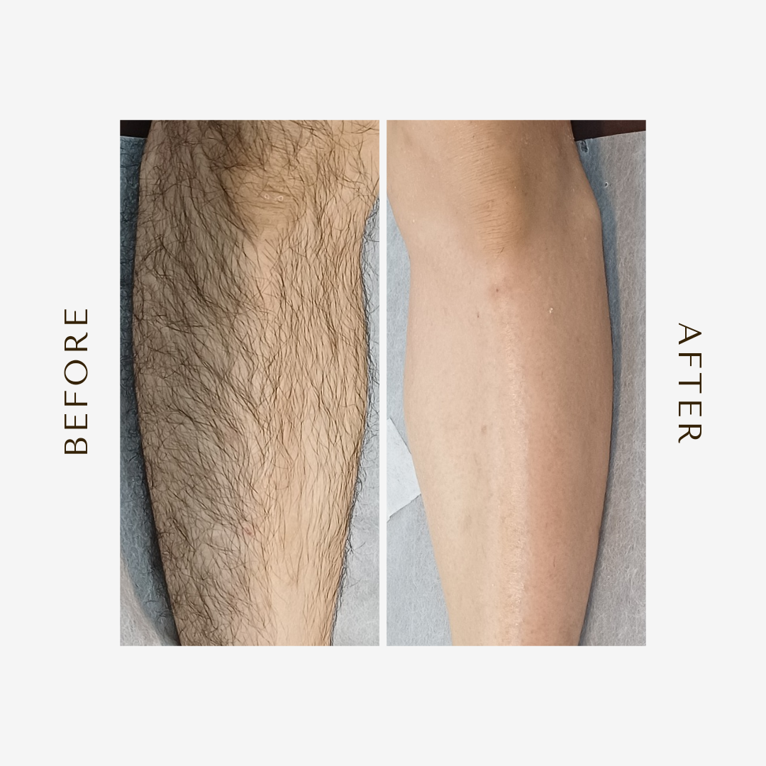 무지개 아로마 테라피 대표 이미지