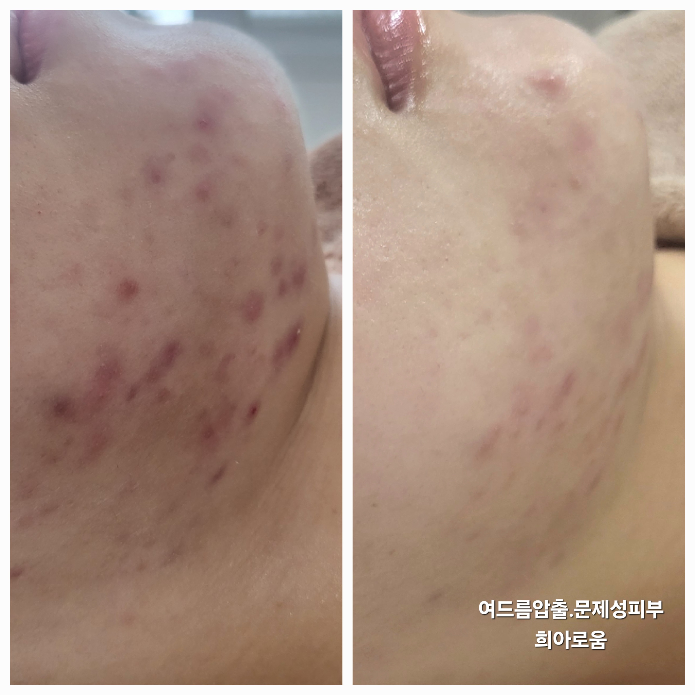 희아로움 마곡본점 대표 이미지