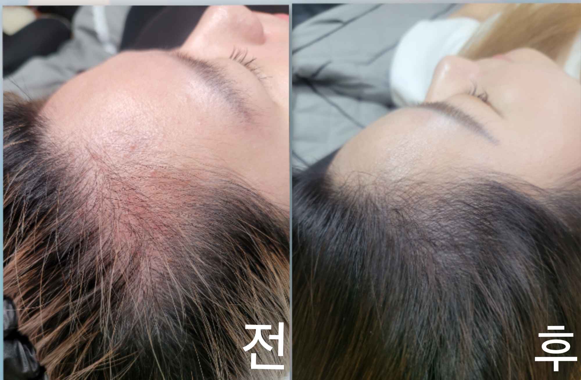 채움솔루션