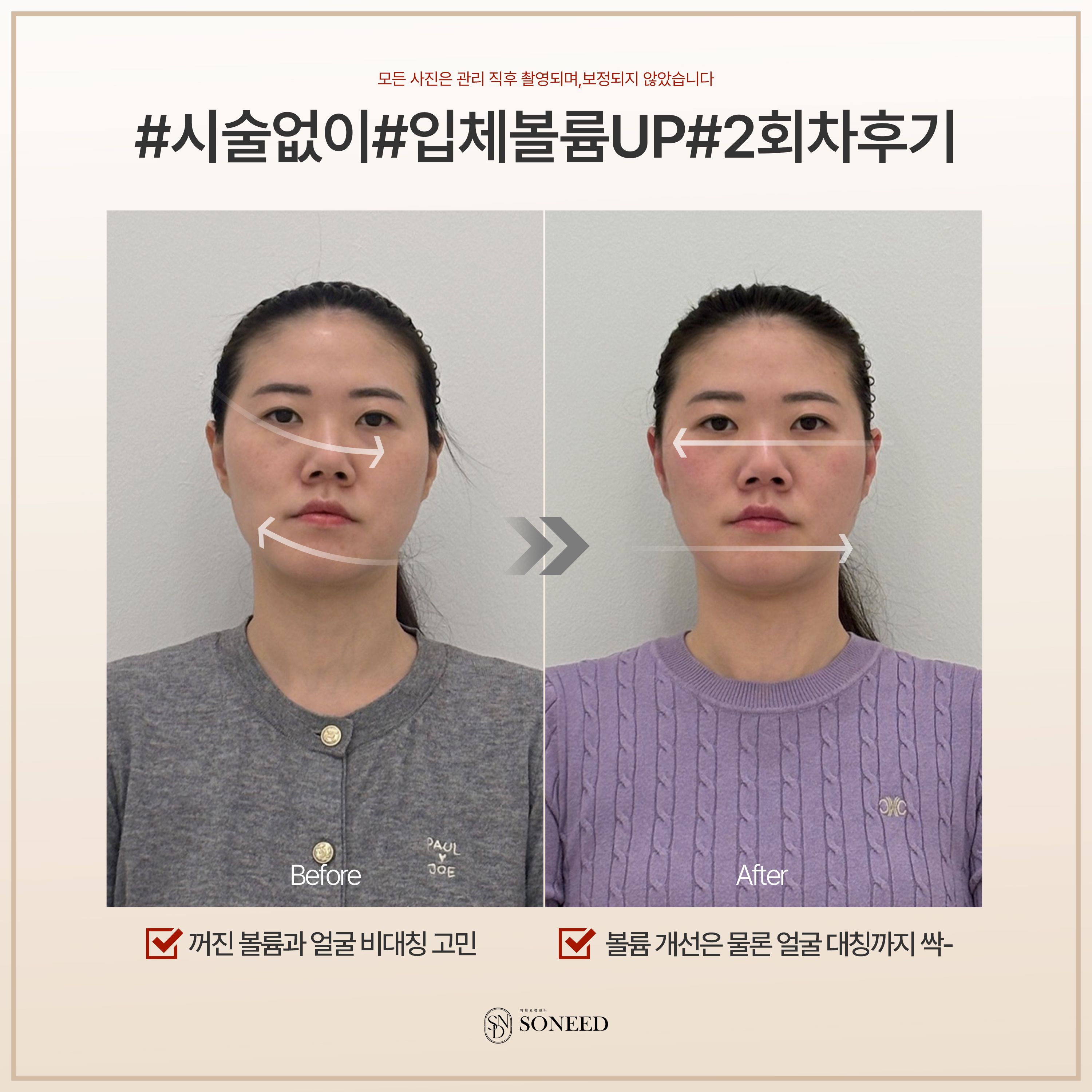 소니드 얼굴윤곽 대치도곡점 대표 이미지