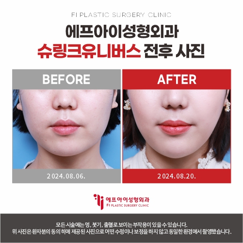 에프아이성형외과의원 대표 이미지