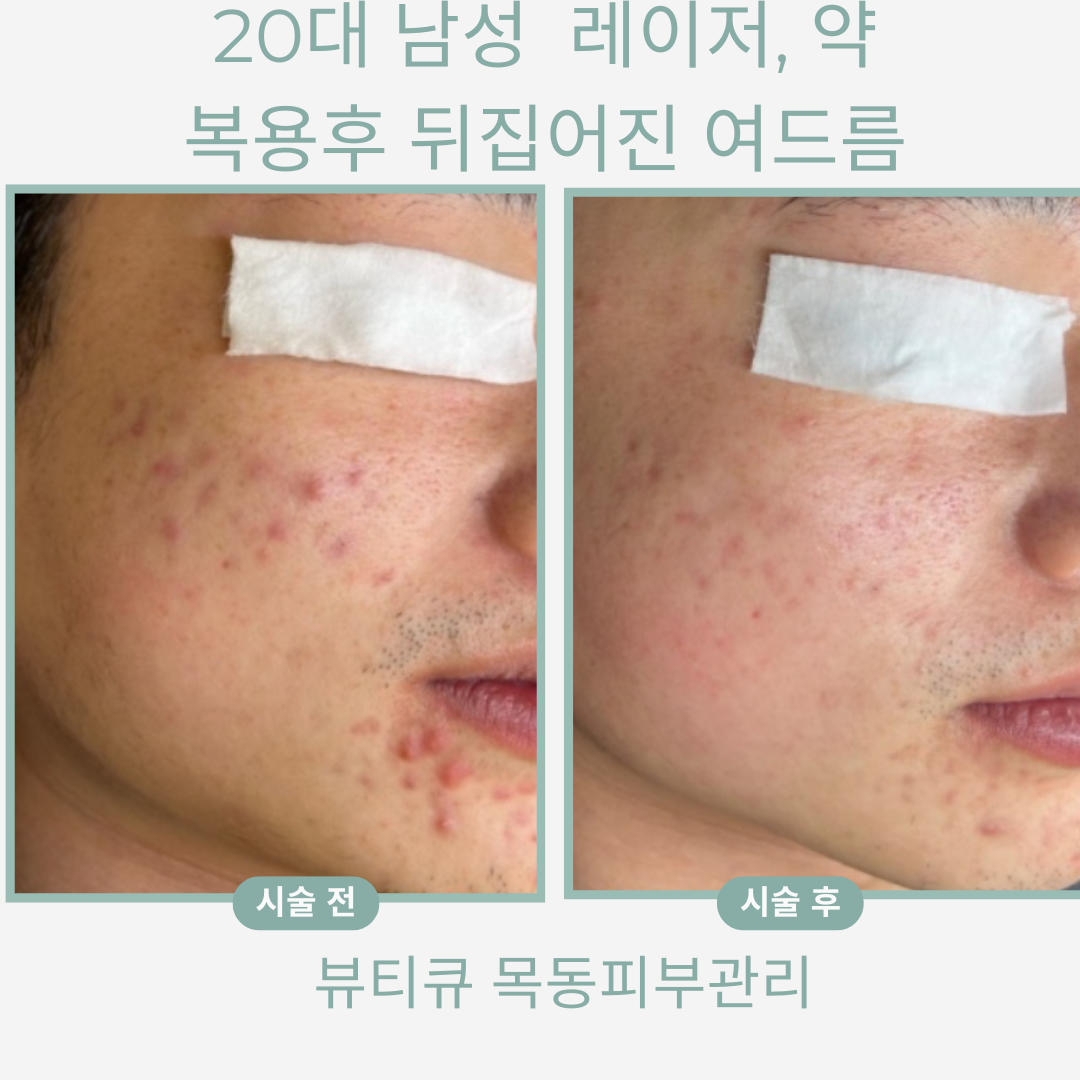 뷰티큐 목동피부관리 대표 이미지