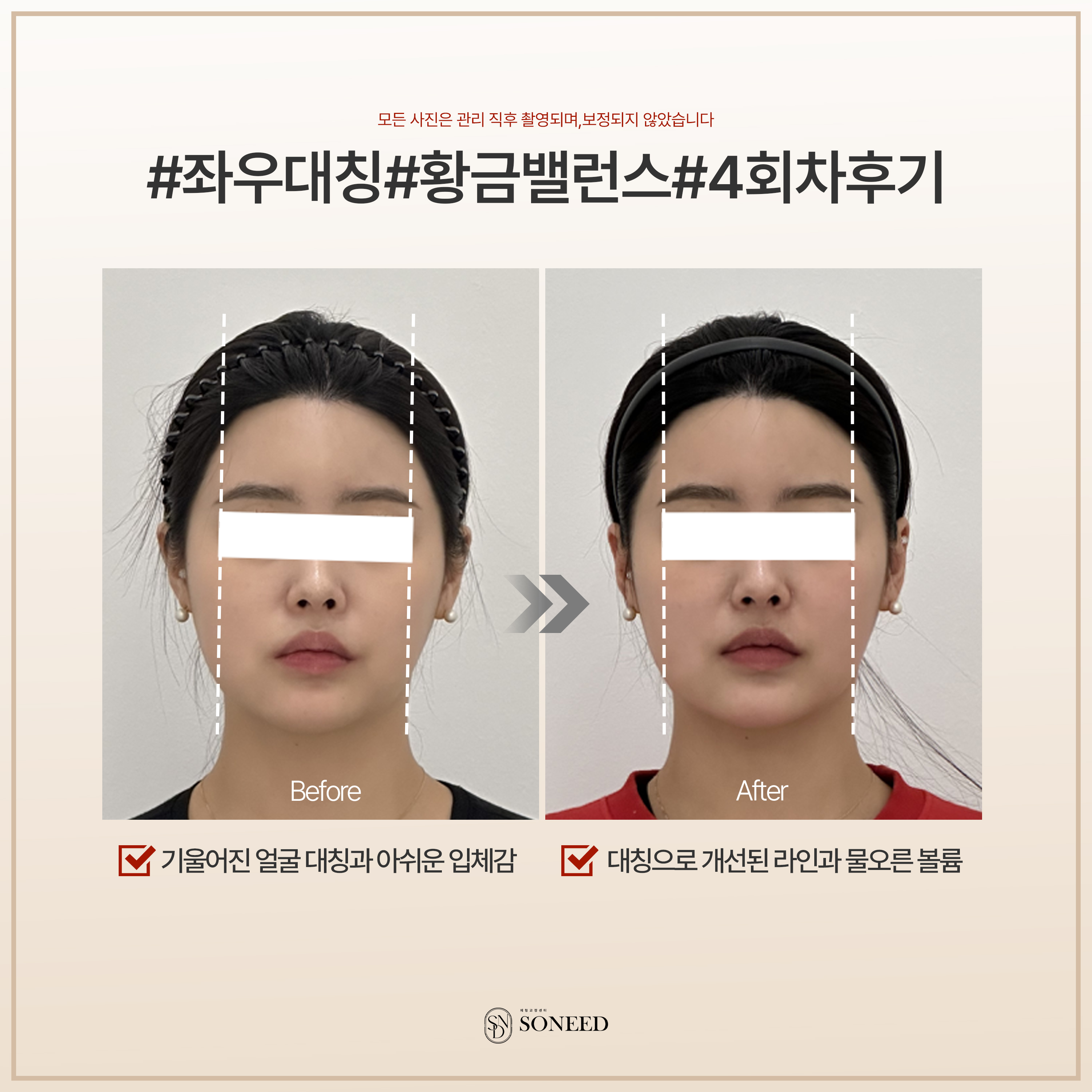 소니드얼굴윤곽 수원광교점 대표 이미지