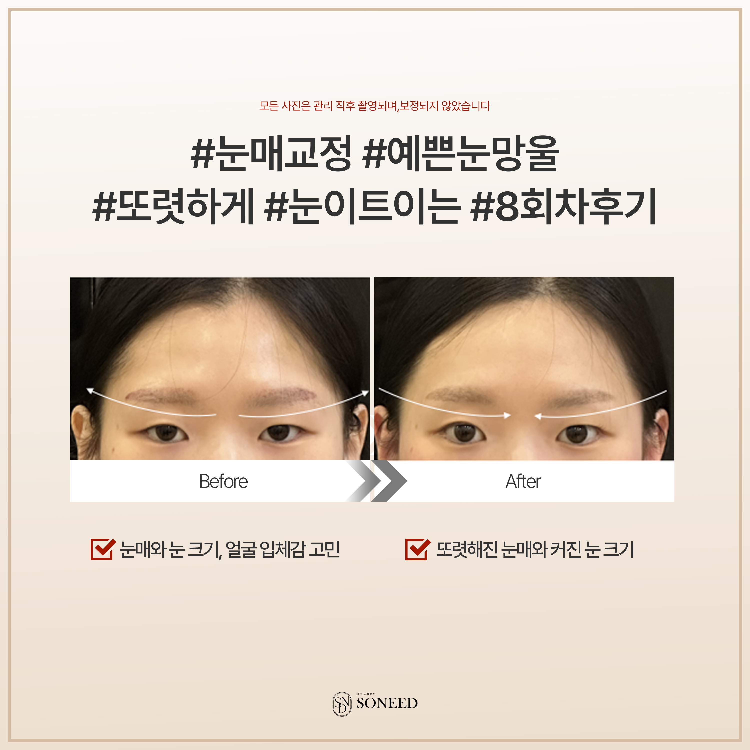 소니드얼굴윤곽 수원광교점 대표 이미지