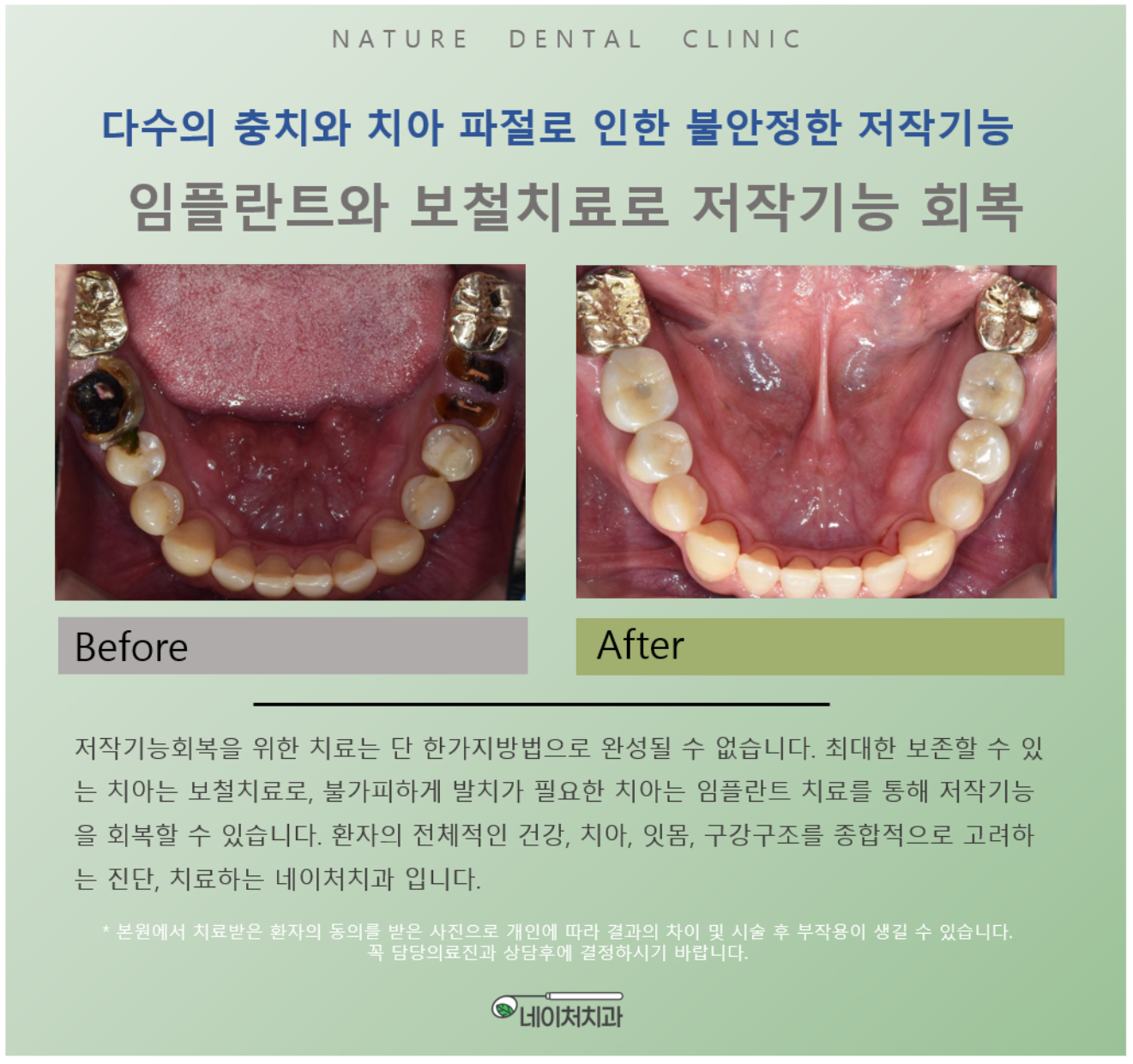 네이처치과의원 대표 이미지